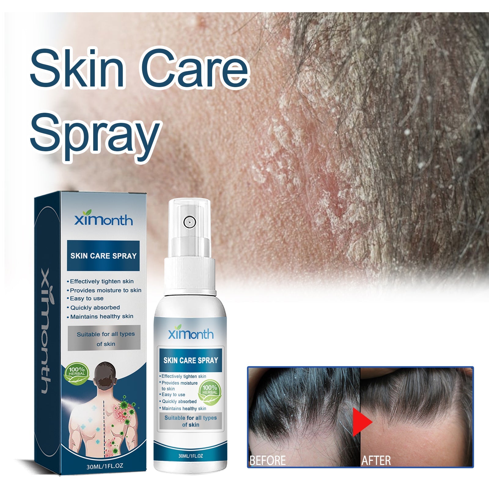 Cowhide Moss Repair Spray Relieves Redness And Itchy Scalp Skin Repair Spray