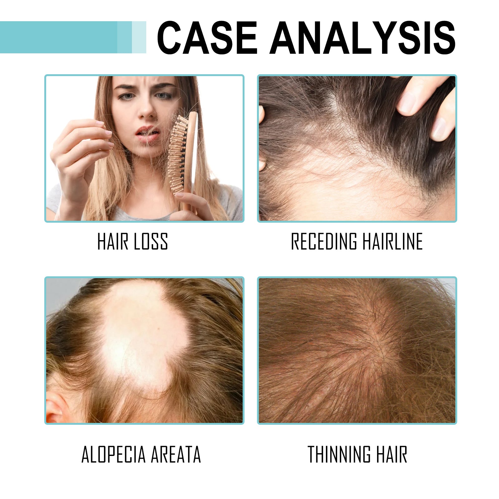 Multi-Peptide Serum For Hair Density, Fall Prevention Dense Hair Repair Damaged Hair Supple Hair Moist Hair Hair Oil