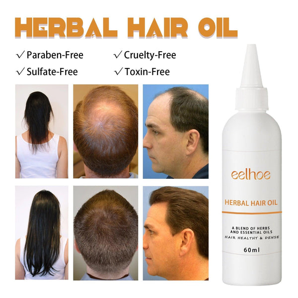 Herb Thickening Hair Oil, Repairing Dry Hair, Moisturizing And Smoothing Hair And Hair Conditioning Oil