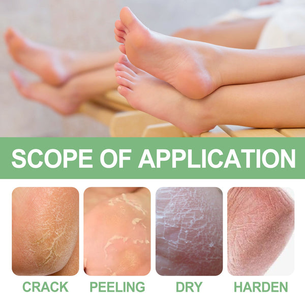 Peppermint Foot Cream, Repair The Foot Prevent Weather-Shack Desquamate Cracked Heels Moisturize Foot Care Cream