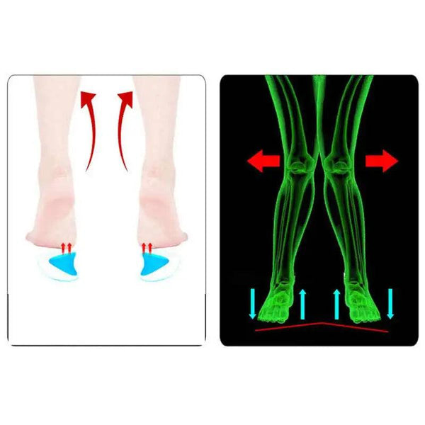 2Pc Arch Support Insole Of Flatfoot Gel Pads For Feet Orthotics Insoles Foot Health Care Massage Muscle Resist Painful Massager