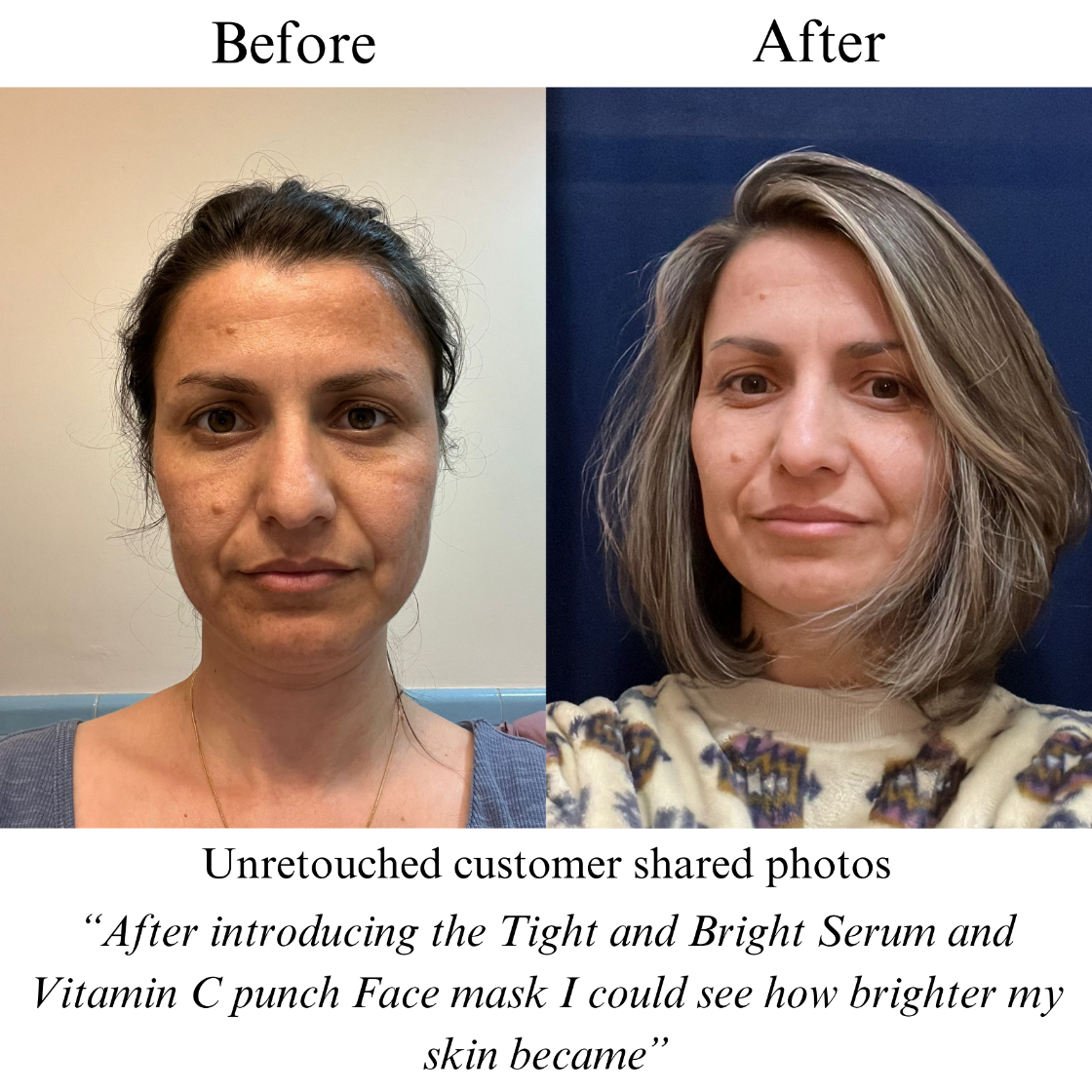 Before and after comparison of a woman's face with text about a skincare product.