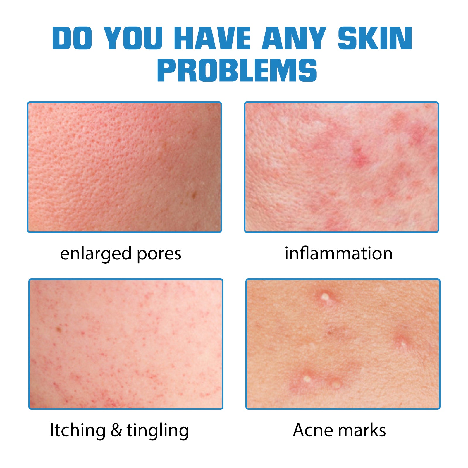 Hyaluronic Acid Face Serum, Moisturizing Repair Lighten Acne Mark Skin Care Whitening Essence