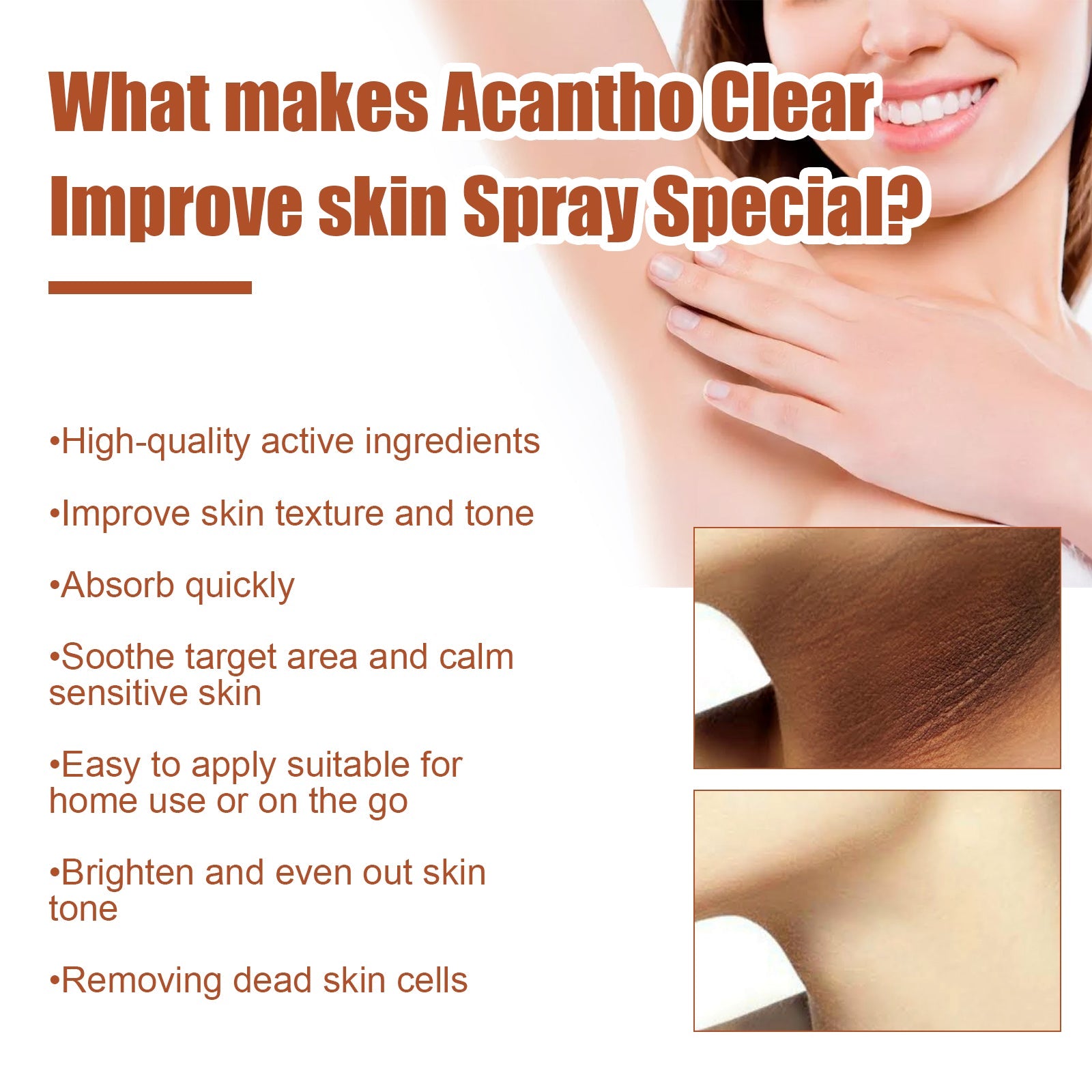 Acantho Clear Improve Skin Spray, Repair Black Spot, Elbow Knee Joint Black Whitening Skin Spray