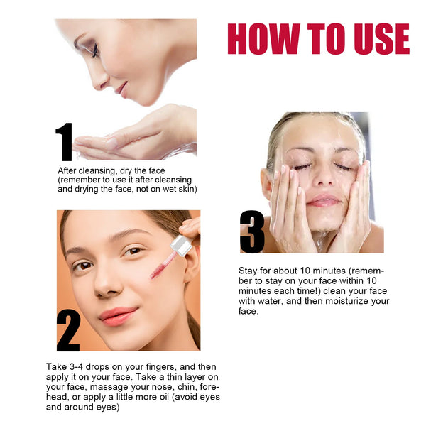 AHA30% + BHA 2% Fruit Acid Salicylic Acid Essence, Exfoliating Cleaning Blackheads Acne And Shrinking Pores Essence