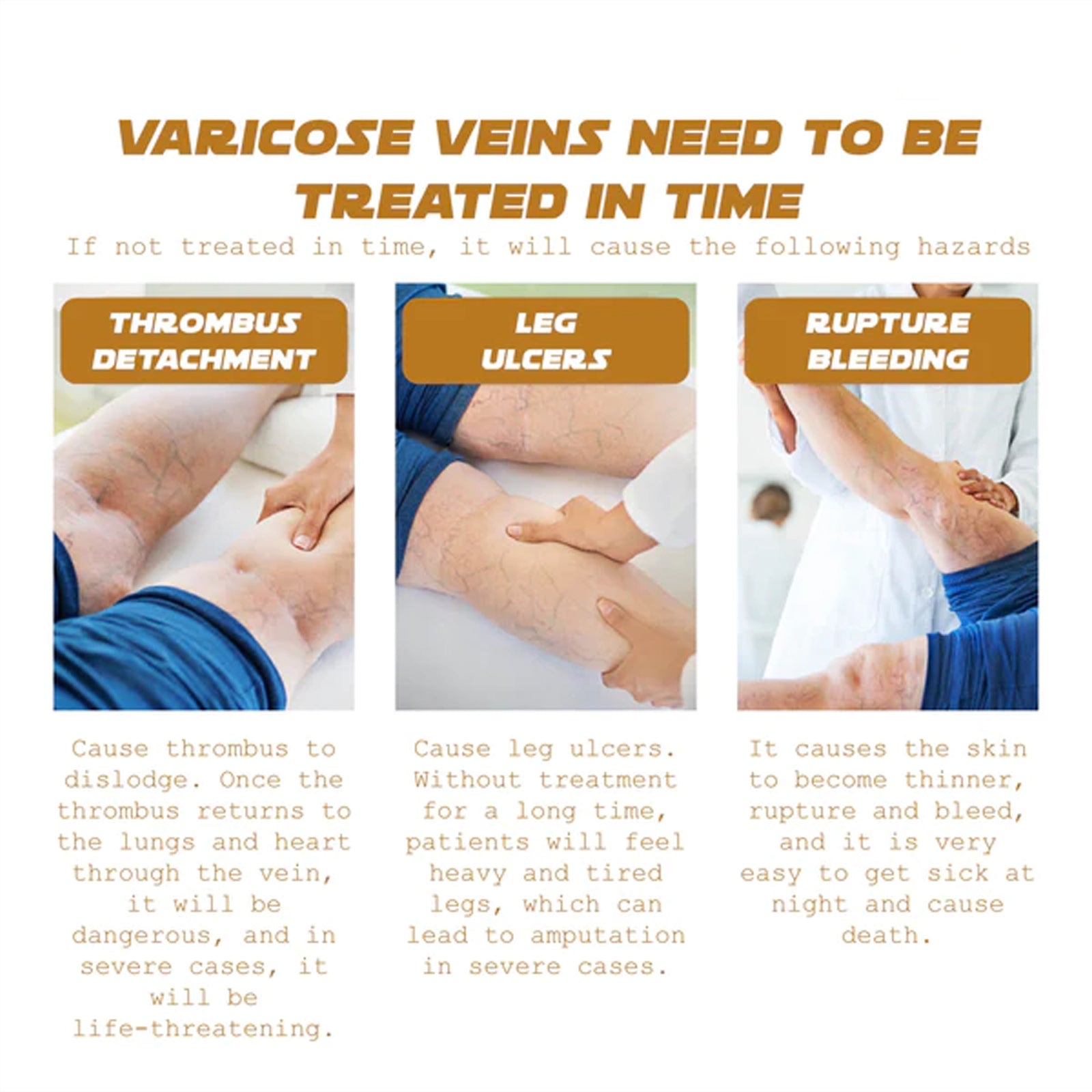 Vein Renewal Smooth Legs Cream, Relief Sore Legs Massage Varicose Earthworm Leg Vein Care Cream