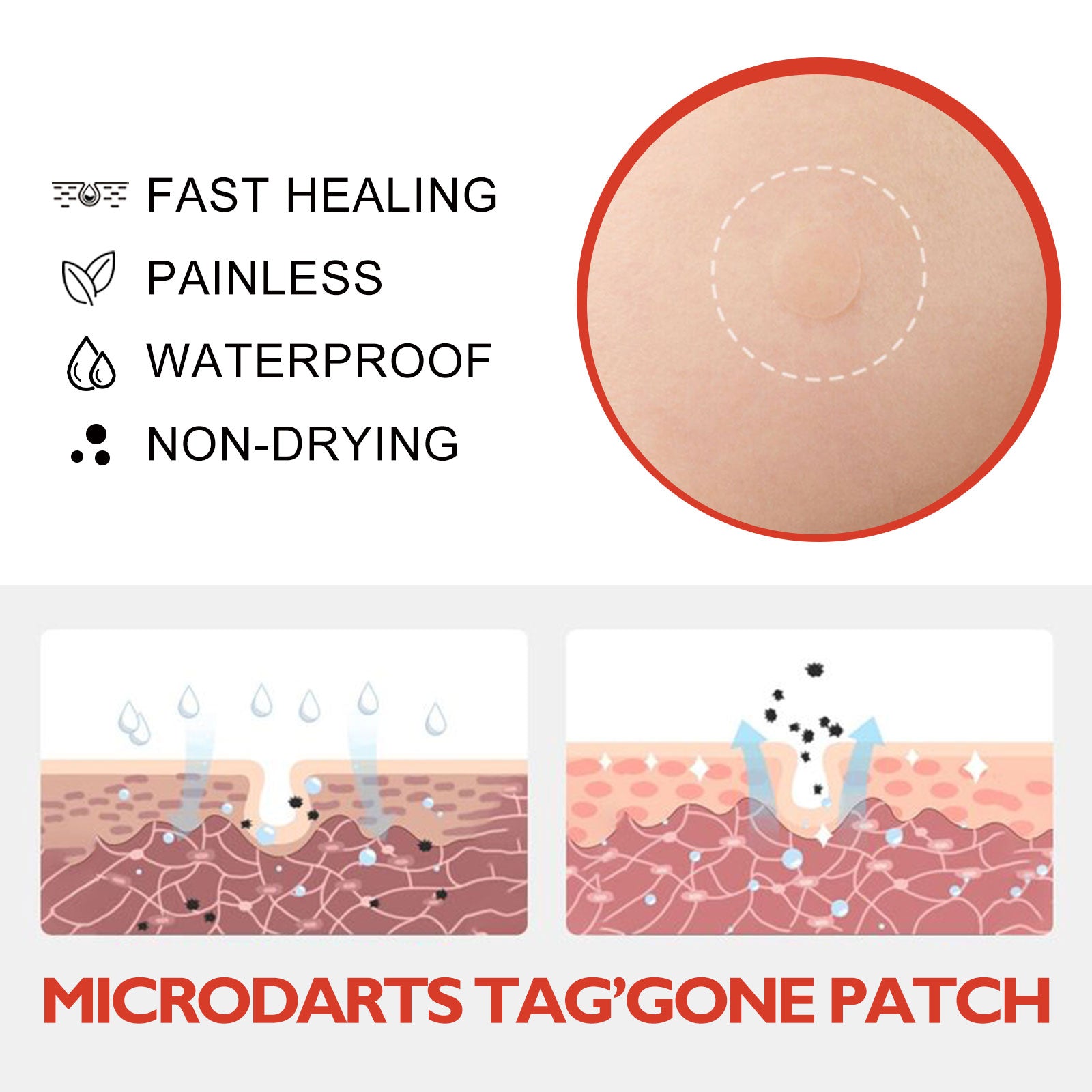 Acne Patch, Skin Clean Acne Pimple Moles Gram Wart Corns Spot Patch