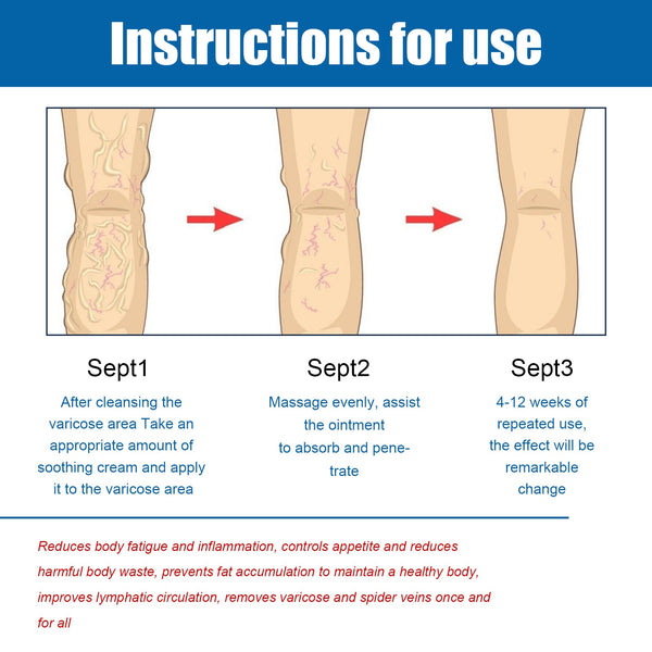 Varicose Vein Slimming Cream, Vein Repair Body Care Reduces Leg Muscle Swelling Earthworm Leg Slimming Cream