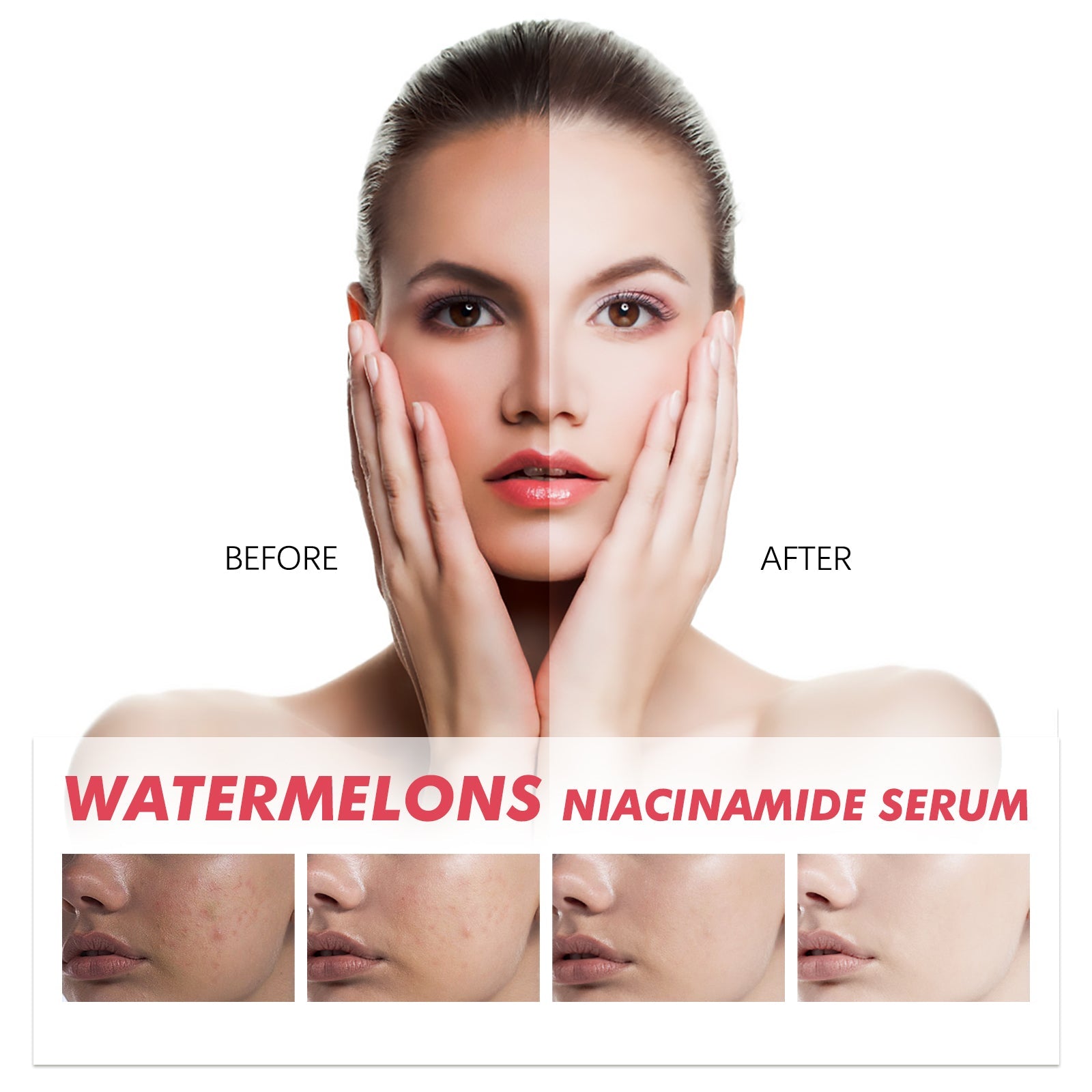 Watermelons Niacinamide Serum, Dilute Spots Firming Haun White Skin Hydrating Moisture Essence