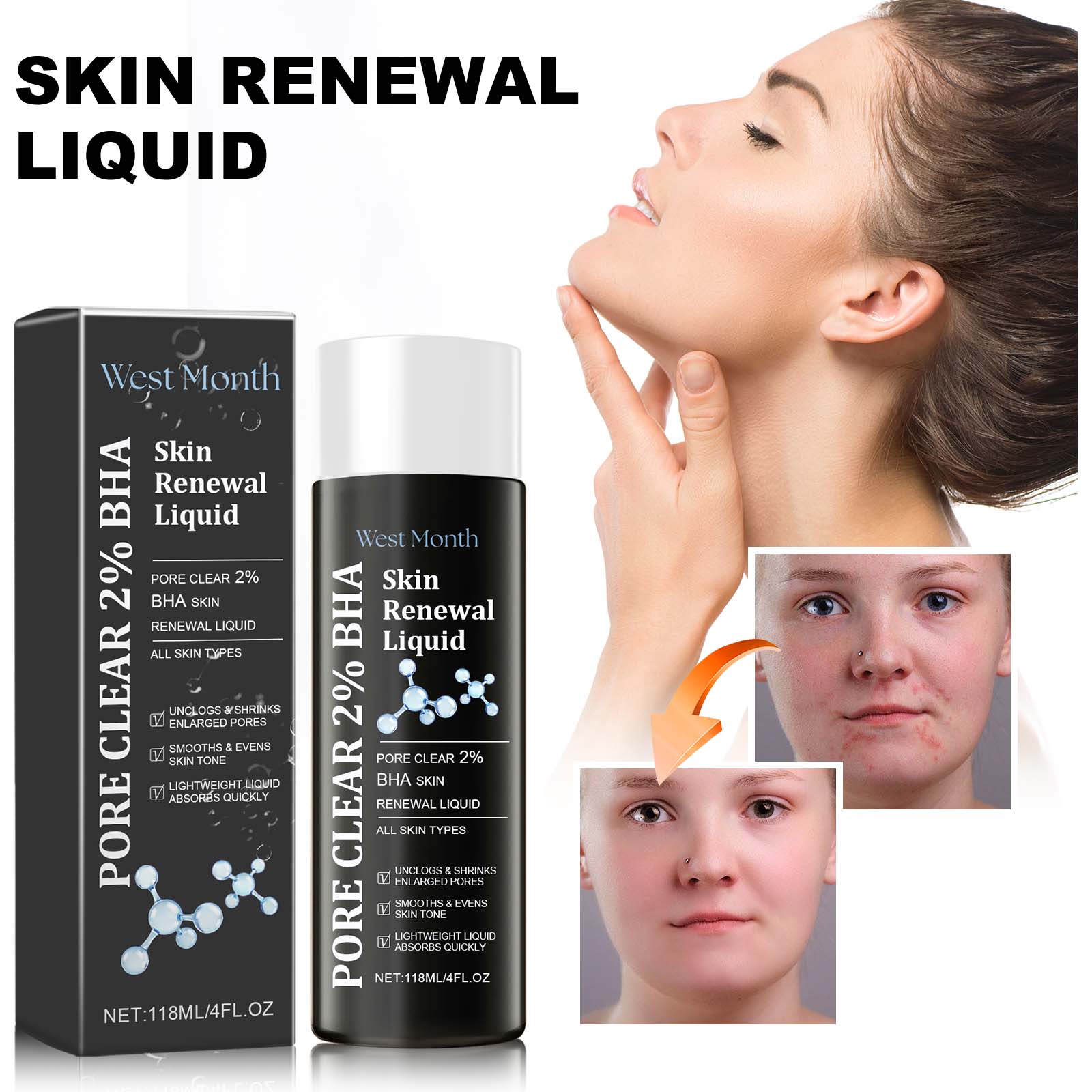 Skin Renewal Liquid, Reduce Acne Print Repair Acne Muscle Mild Clear Acne Hydrating Essence