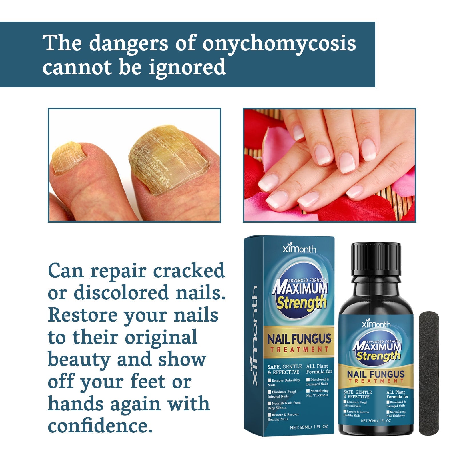 Nail Fungus Treatment, Nail Thickening Of Embedded Light Mail This Soft Armour Brothers Nails Detailer