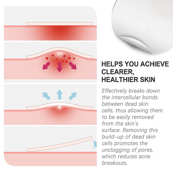 Acne Patch, Repair Acne Pimples Acne Invisible Concealer Breathable Acne Patch