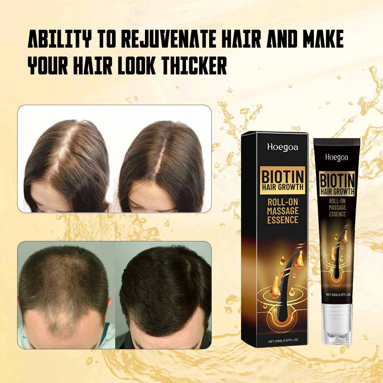 Biotin Hair Growth Roll On Massage Essence, Strong Hair Nourishing Hair Root Repair Dry Hair Essence