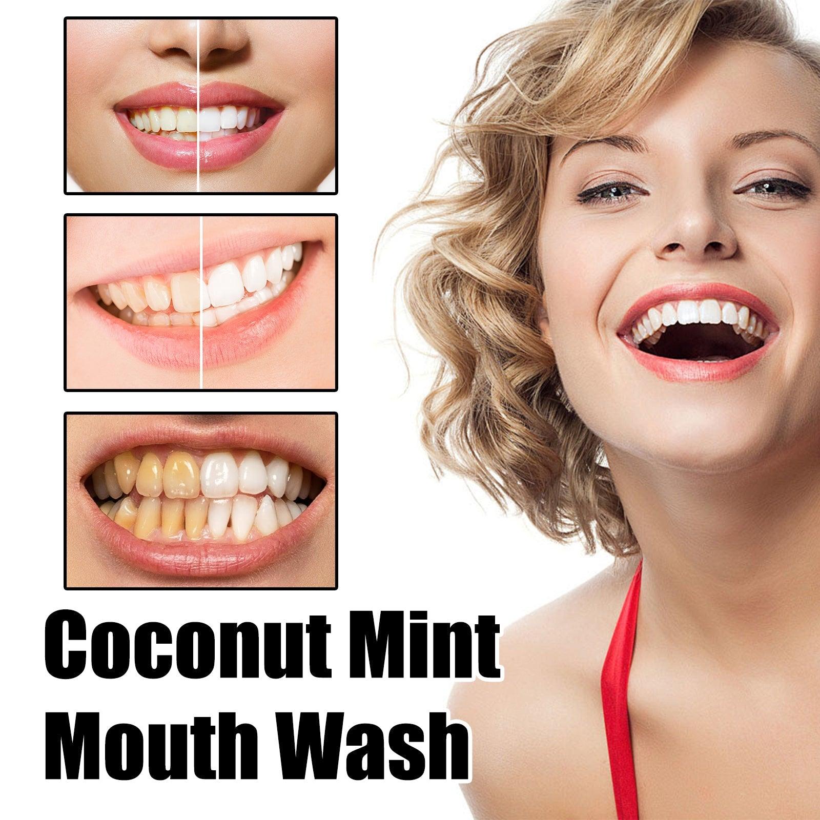 Teeth Rinse, Deep Clean Mouth Fresh, Deodorizing And Whitening Teeth Stain Removing Mouthwash