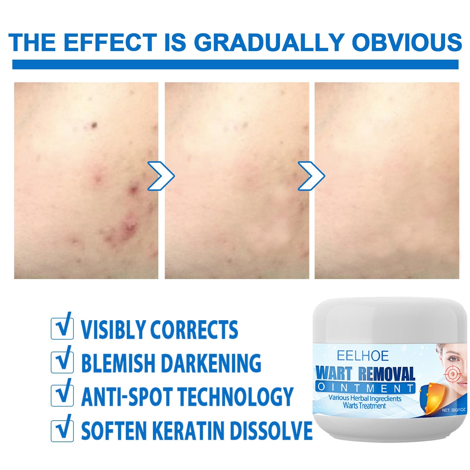 Skin Care Cream, Care For The Body Skin Moisturizing, Soft, Clean Skin Care Repair Skin Care Cream