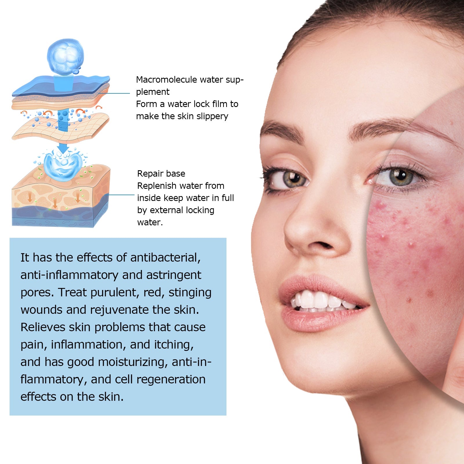 Hyaluronic Acid Face Serum, Moisturizing Repair Lighten Acne Mark Skin Care Whitening Essence