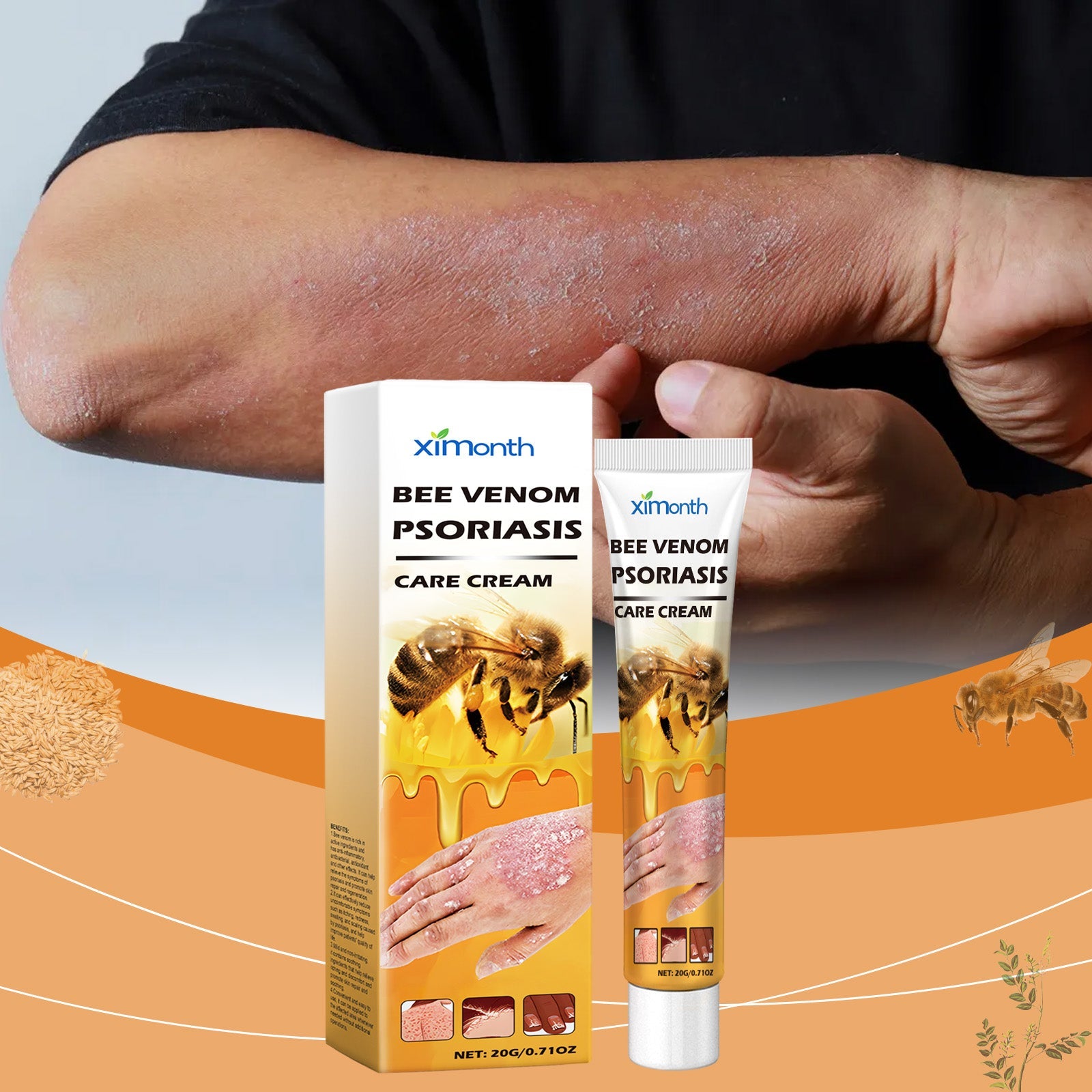 Bee-Venom Cowhide Moss Care Cream Moisturizes And Restores Itchy Red And Swollen Hands And Feet Skin Care Cream