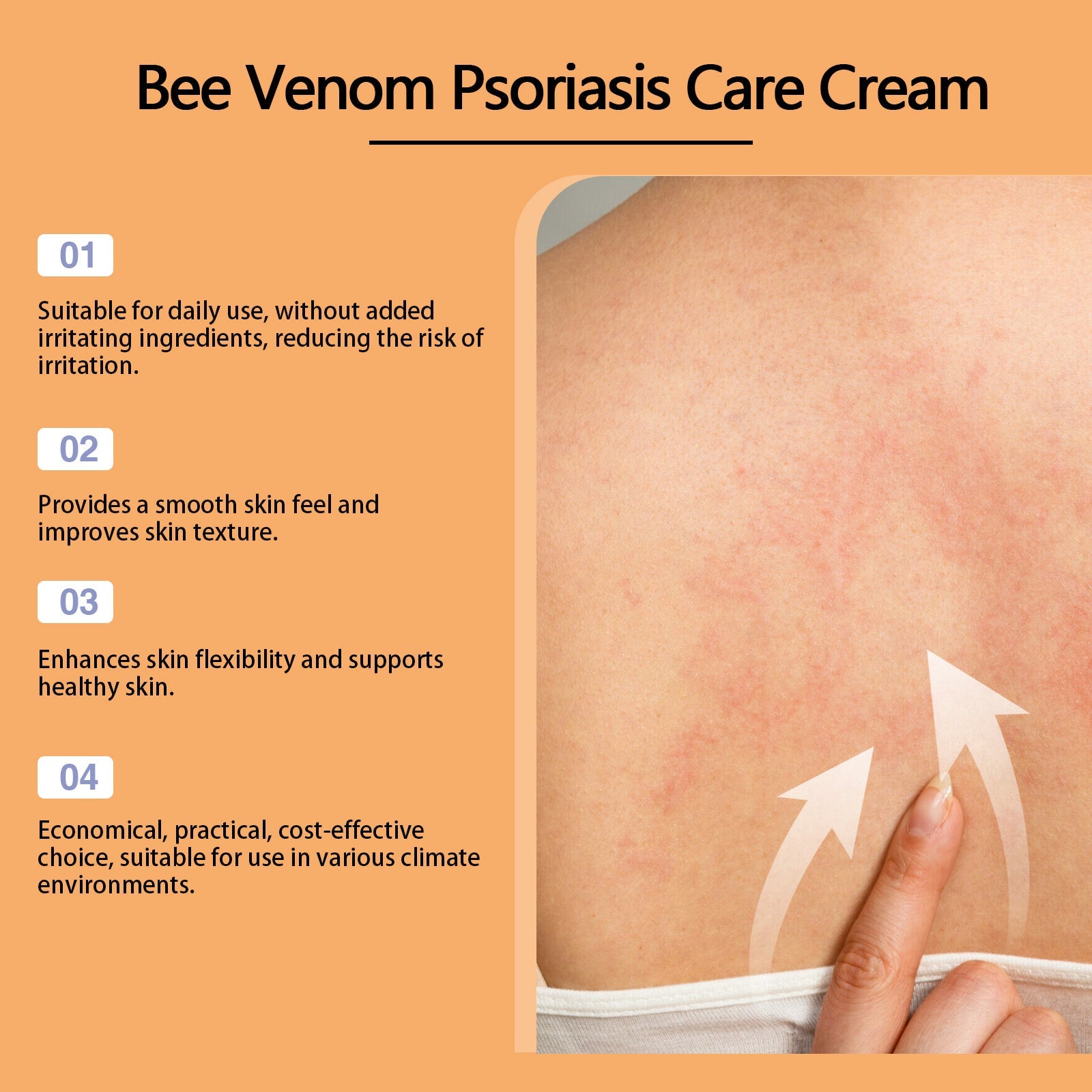 Bee-Venom Cowhide Moss Care Cream Moisturizes And Restores Itchy Red And Swollen Hands And Feet Skin Care Cream