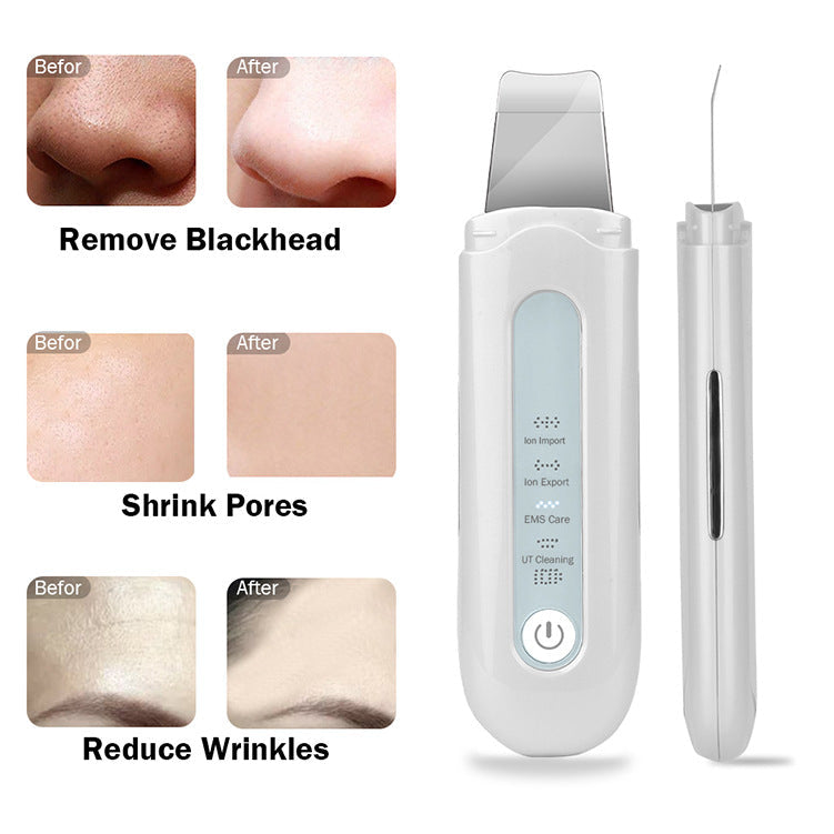 HailiCare New Ultrasonic Peeling Machine Pore Cleaner Horny Blackhead