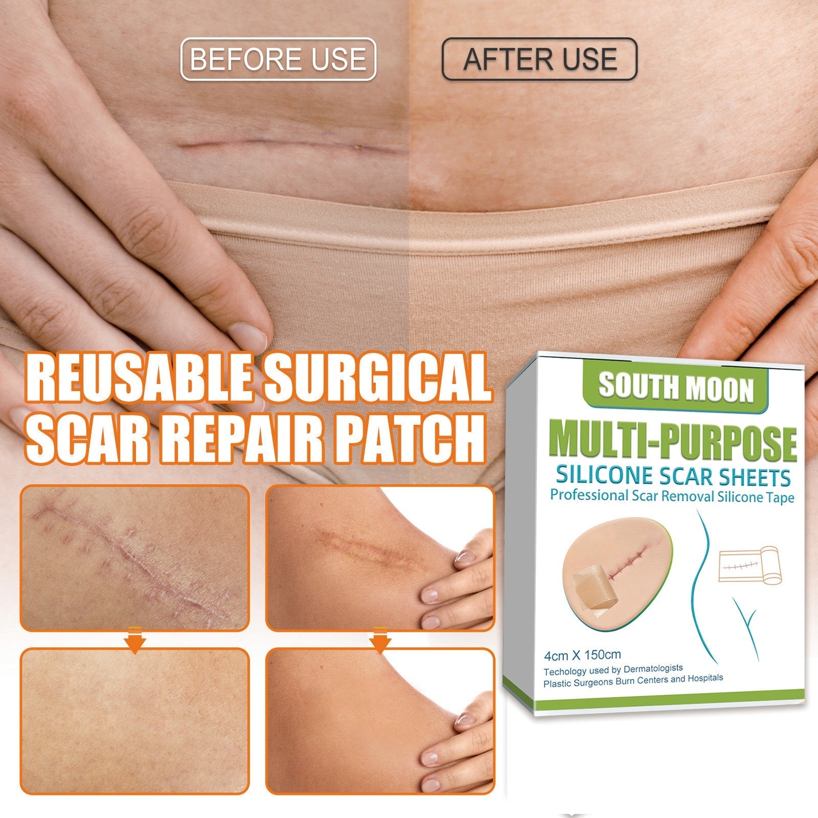 Skin Care Patch for Reducing Skin Imperfections with Gentle Ingredients for Daily Use