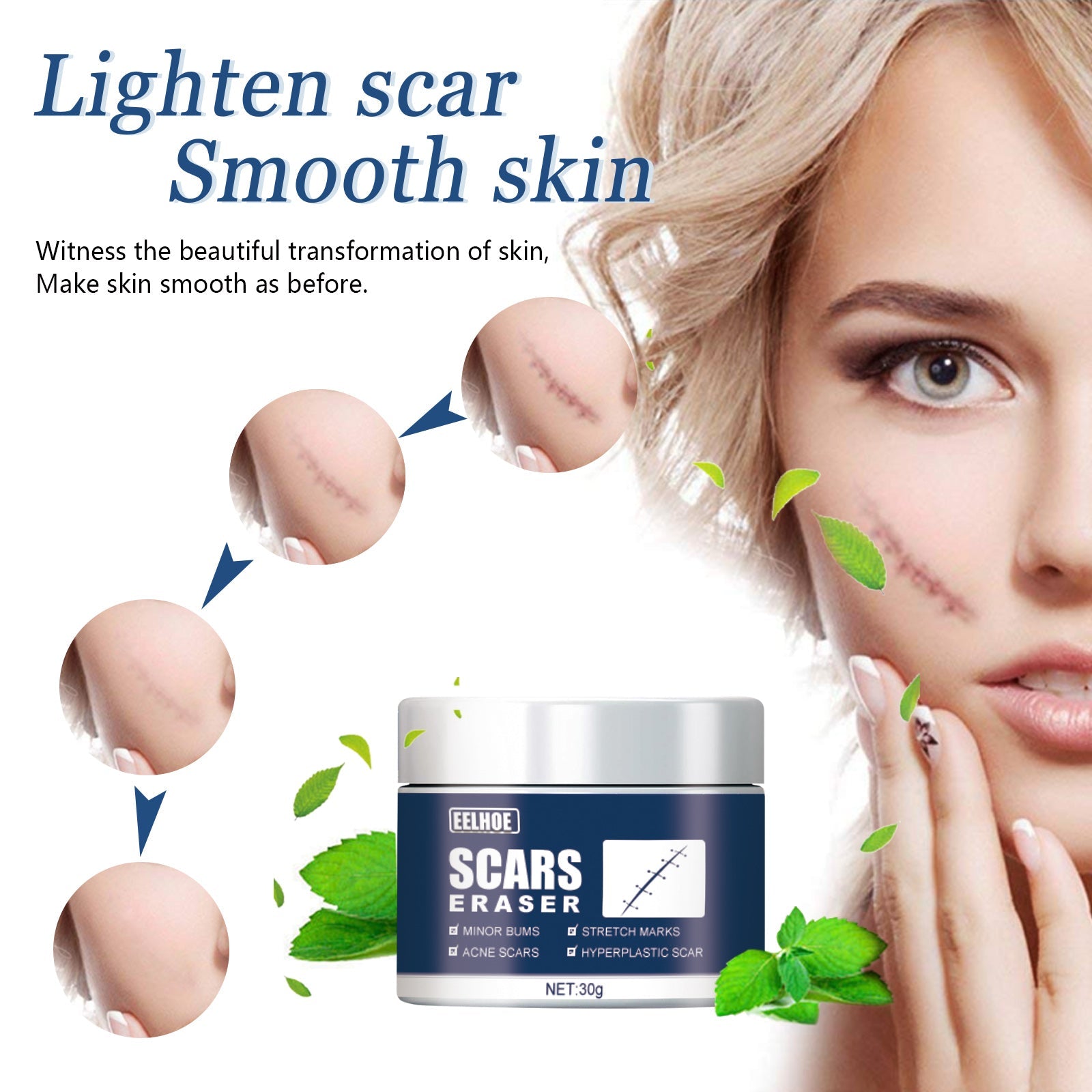 Scar Balm, Surgery Scar Repair Cold Compress Scar Skin Scar Gel Balm