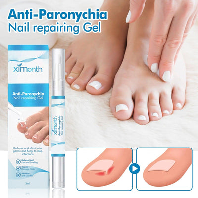 Anti-Paronychia Nail Repairing Gel, Repair Encased Rotten Nails Soft Nails Thickening Pain Relief Cleansing Care