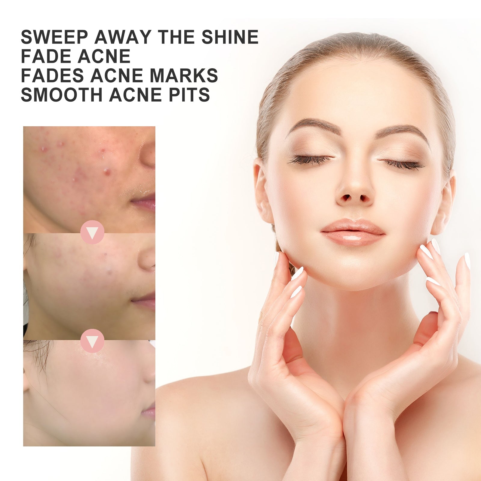 Acne Patch, Repair Acne Pimple Facial Redness Clean Pores Moisturize Skin Patch