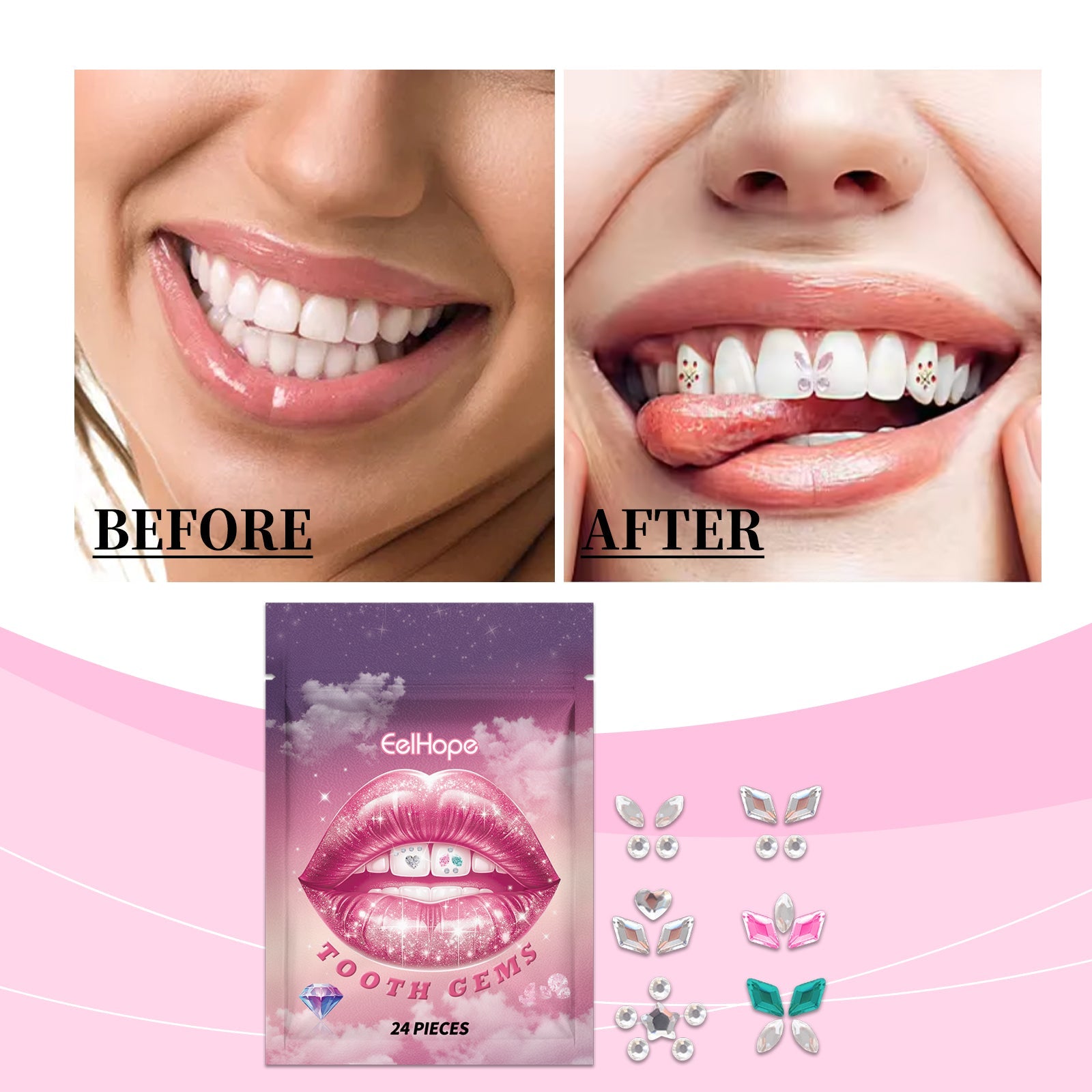 Crystal Dental Drill To Brighten Your Smile For A Long Time With Easy Use Of The Suitable Tooth Type Adhesive