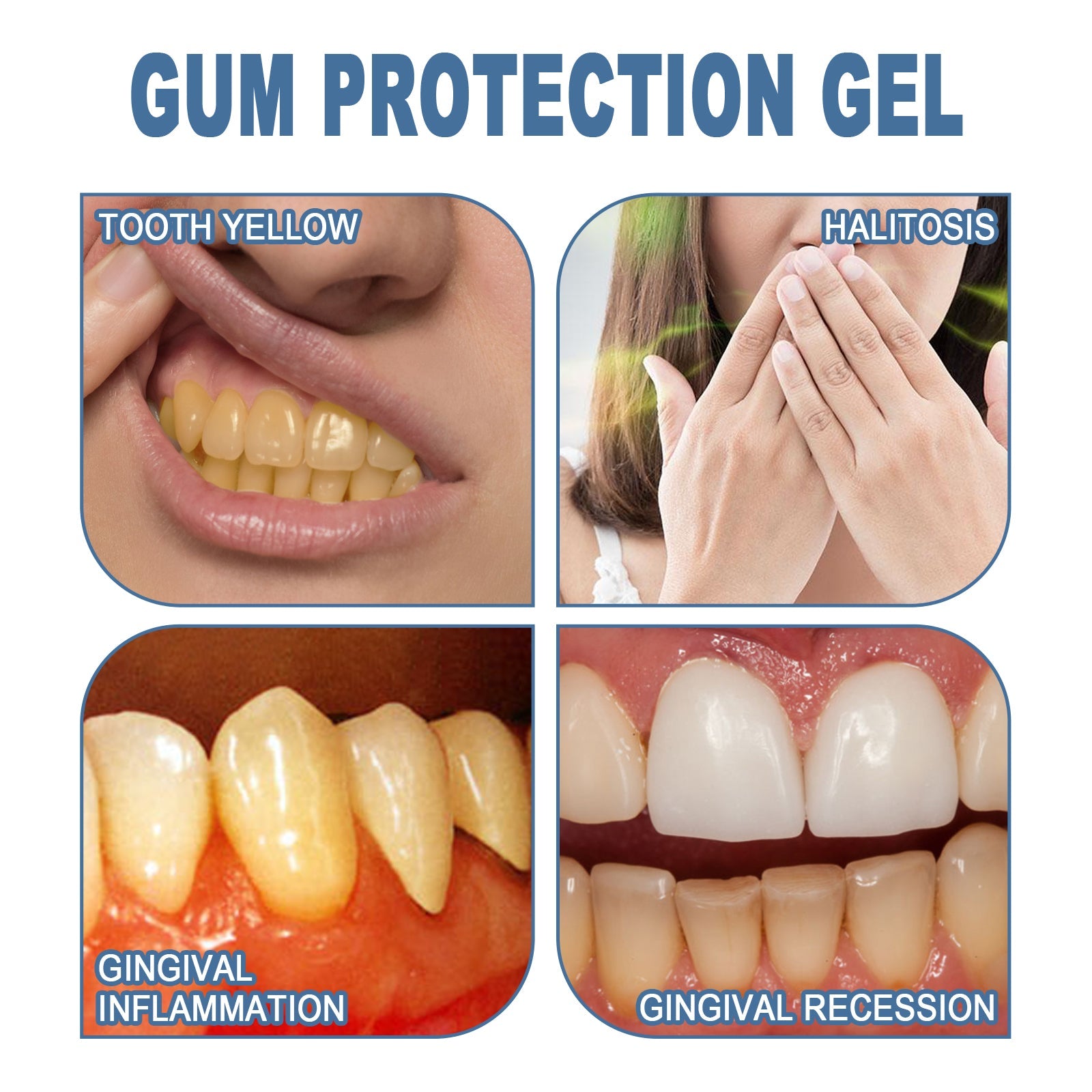 Gum Protection Gel, Teeth Whitening And Whitening Gum Repair Oral Cleaning And Care Dental Pencil