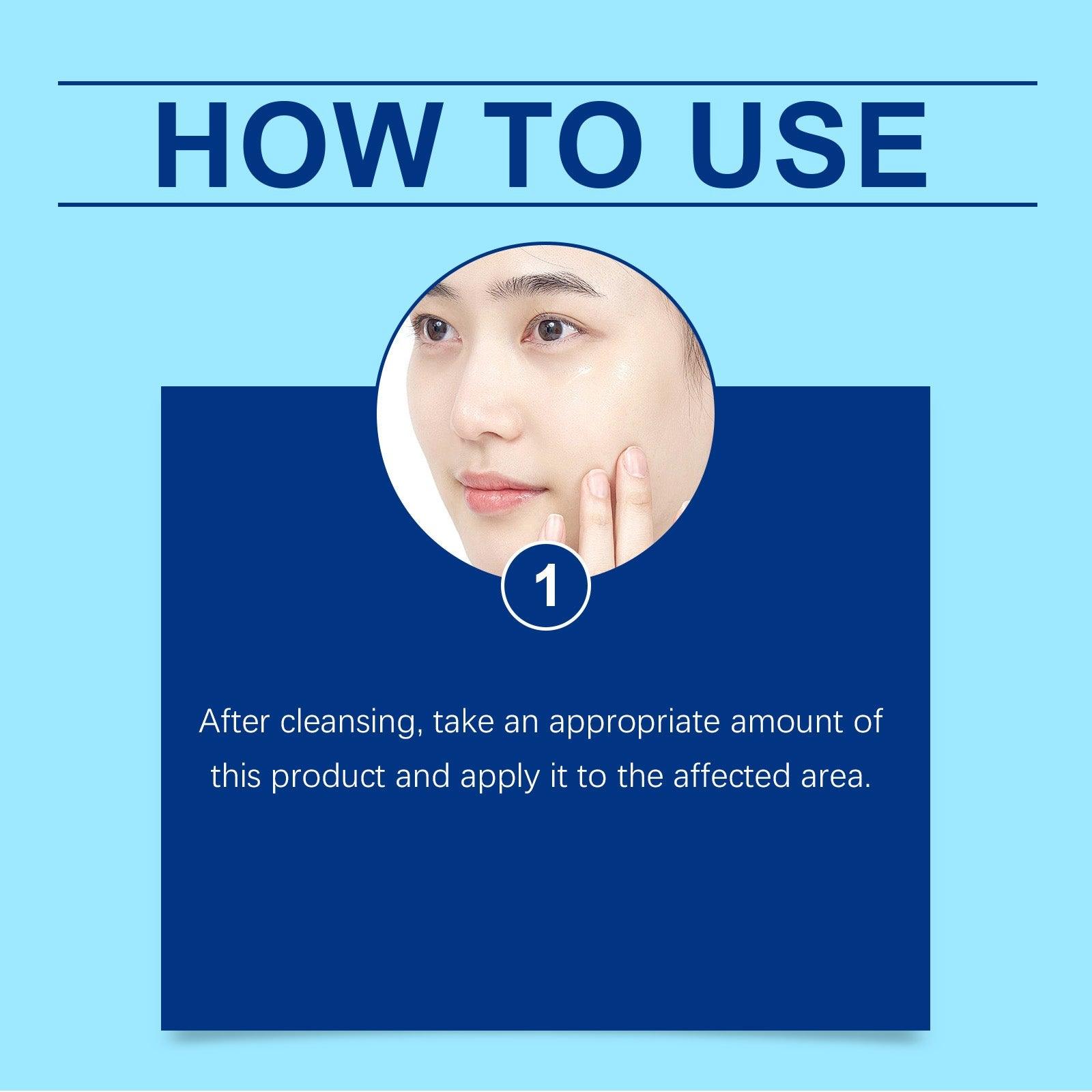 Retinol Gel Gently Cleanses Face Acne Care And Improves Skin Gel