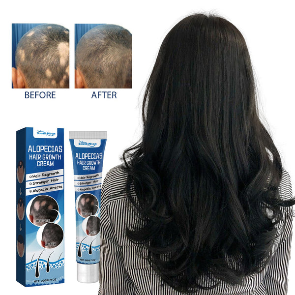 Alopecias Hair Growth Cream, Protect Hair Follicles Strong Moisturizing Thick Hairline Hair