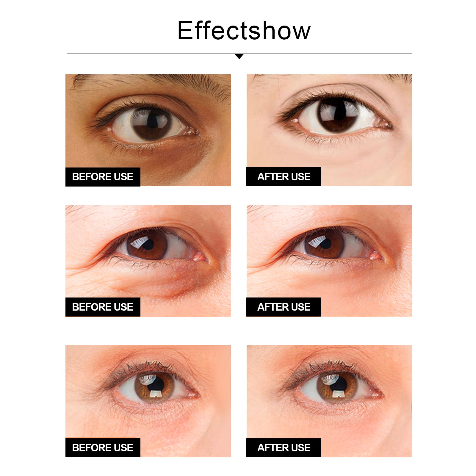 Snake Venom Eye Cream, Firming Eye Bags Hydrating And Reducing Fine Lines Eye Care Eye Cream