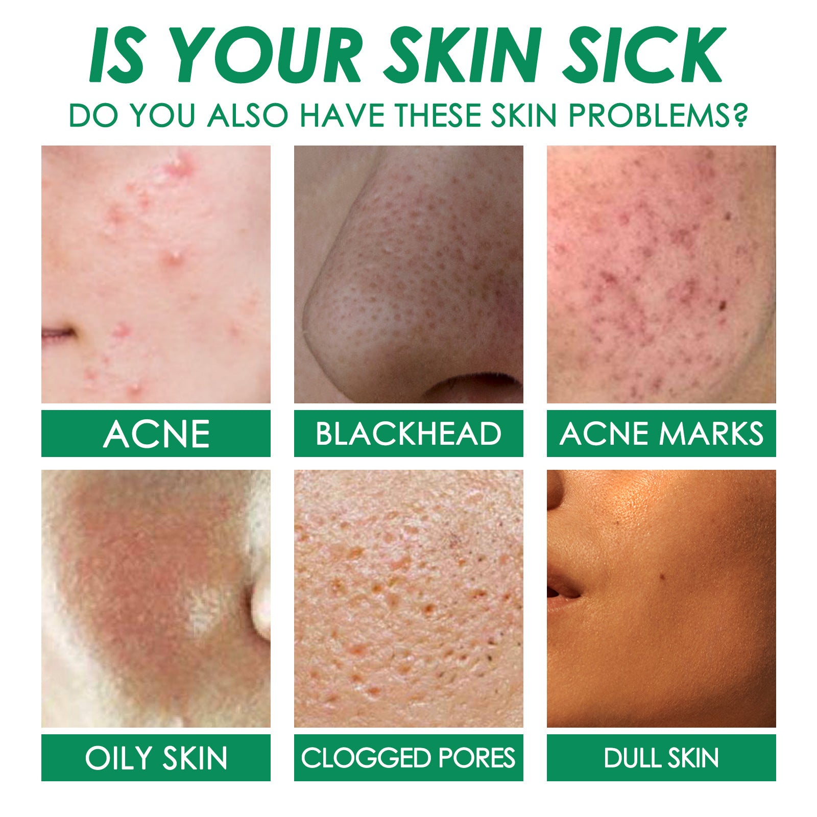 Facial Green Tea Vitamin Cleanse Mask, Facial Acne Deep Moisturizing Smear Delicate Pores Tender Skin