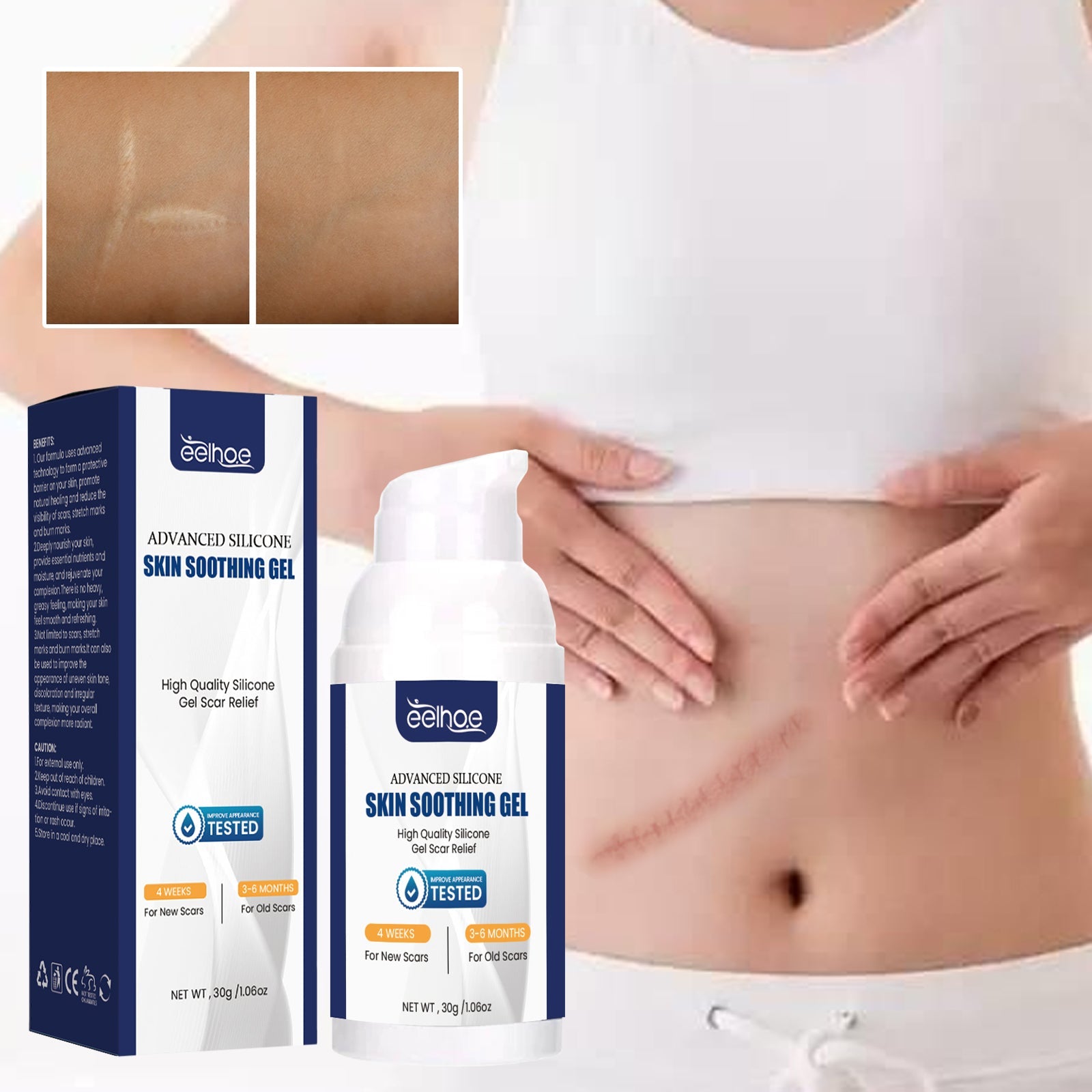 Scar Gel, Fade Skin Scar Pregnancy Surgery Scar Moisturizing Skin Care Gel