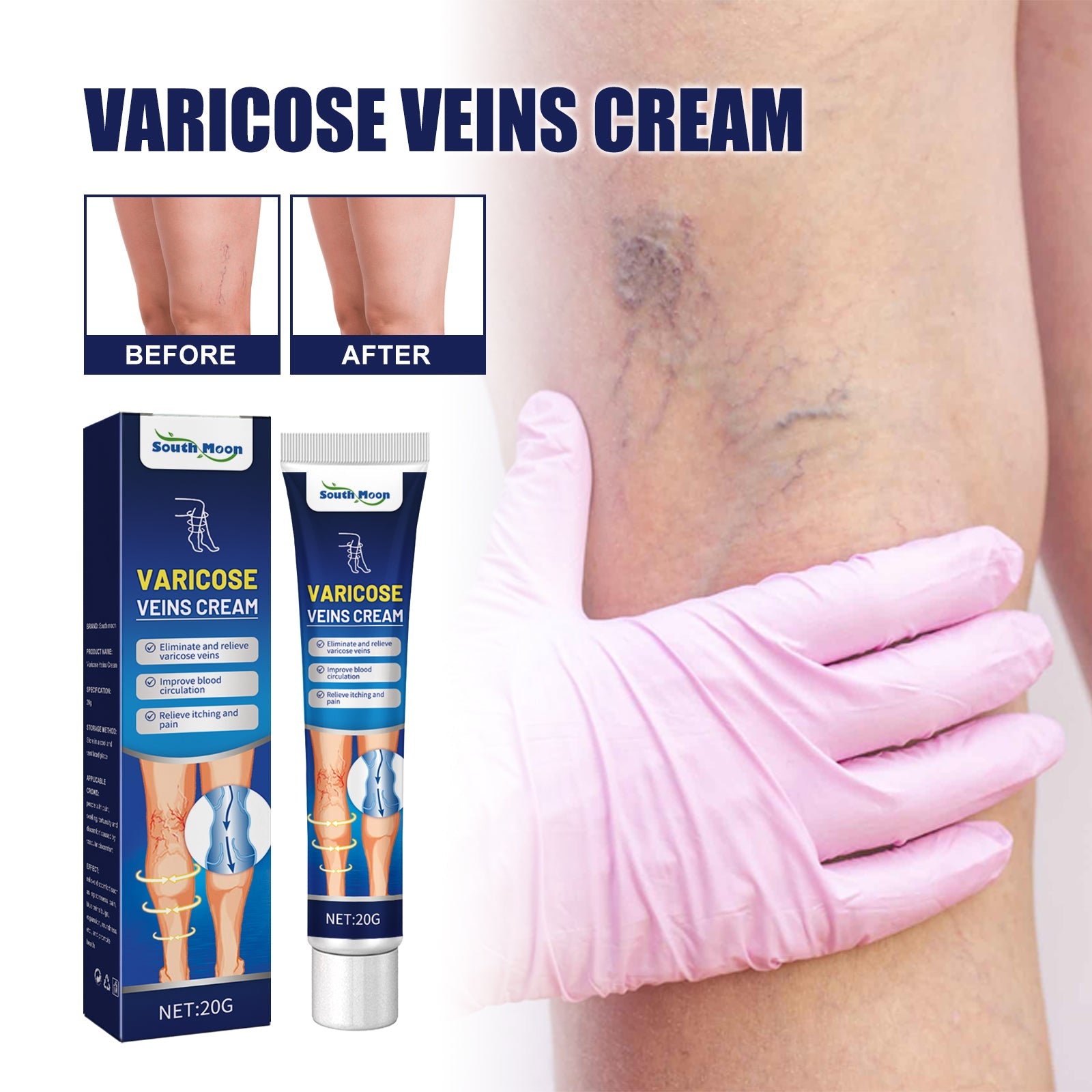 Vein Massage Varicose Cream Repair Earthworm Legs To Relieve Leg Blood Vessel Bulge And Varicoidea