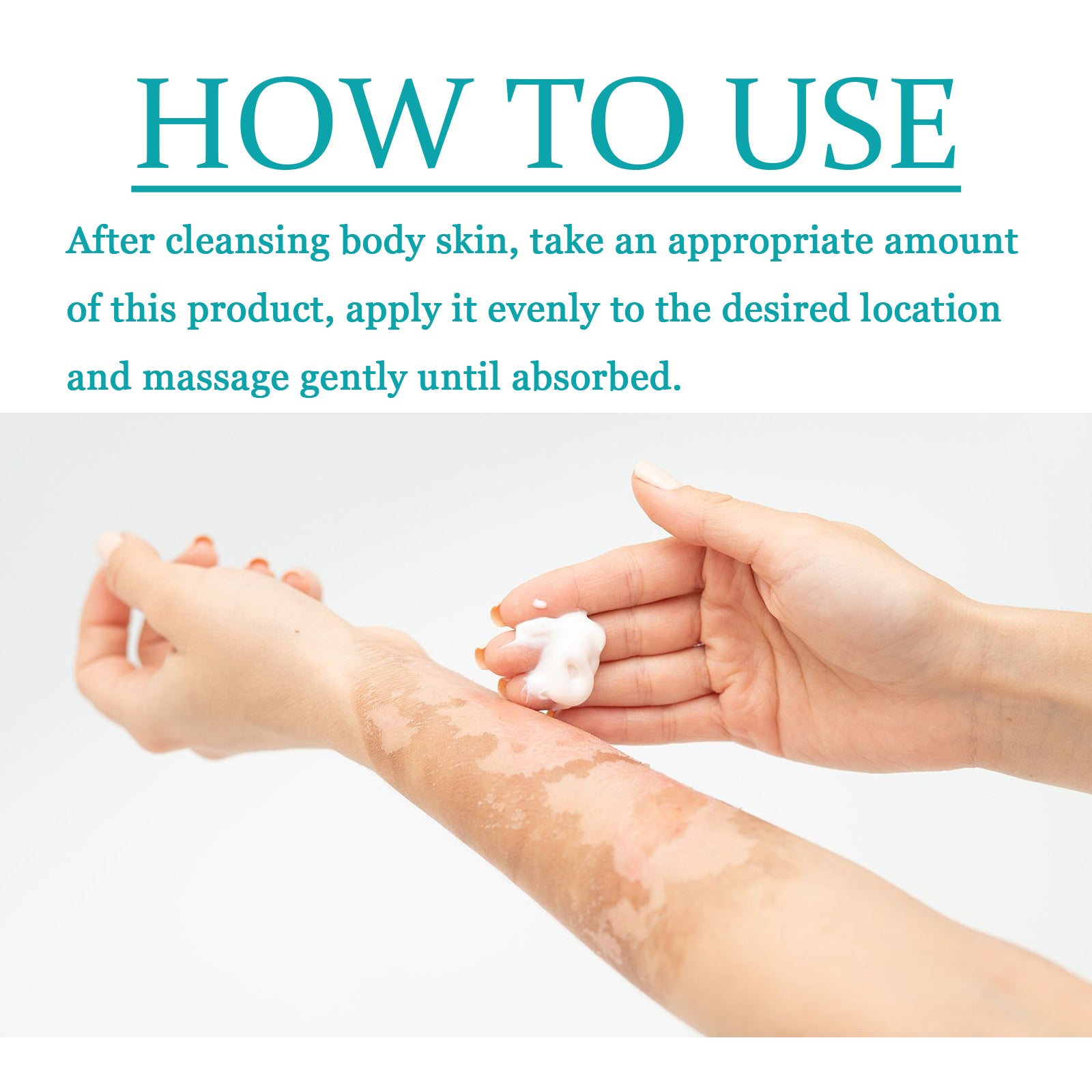 Vitiligo Fix Revitalizing Elixir, Lighten Skin Spots Even Skin Tone Moisturizing Body Care Repair Cream