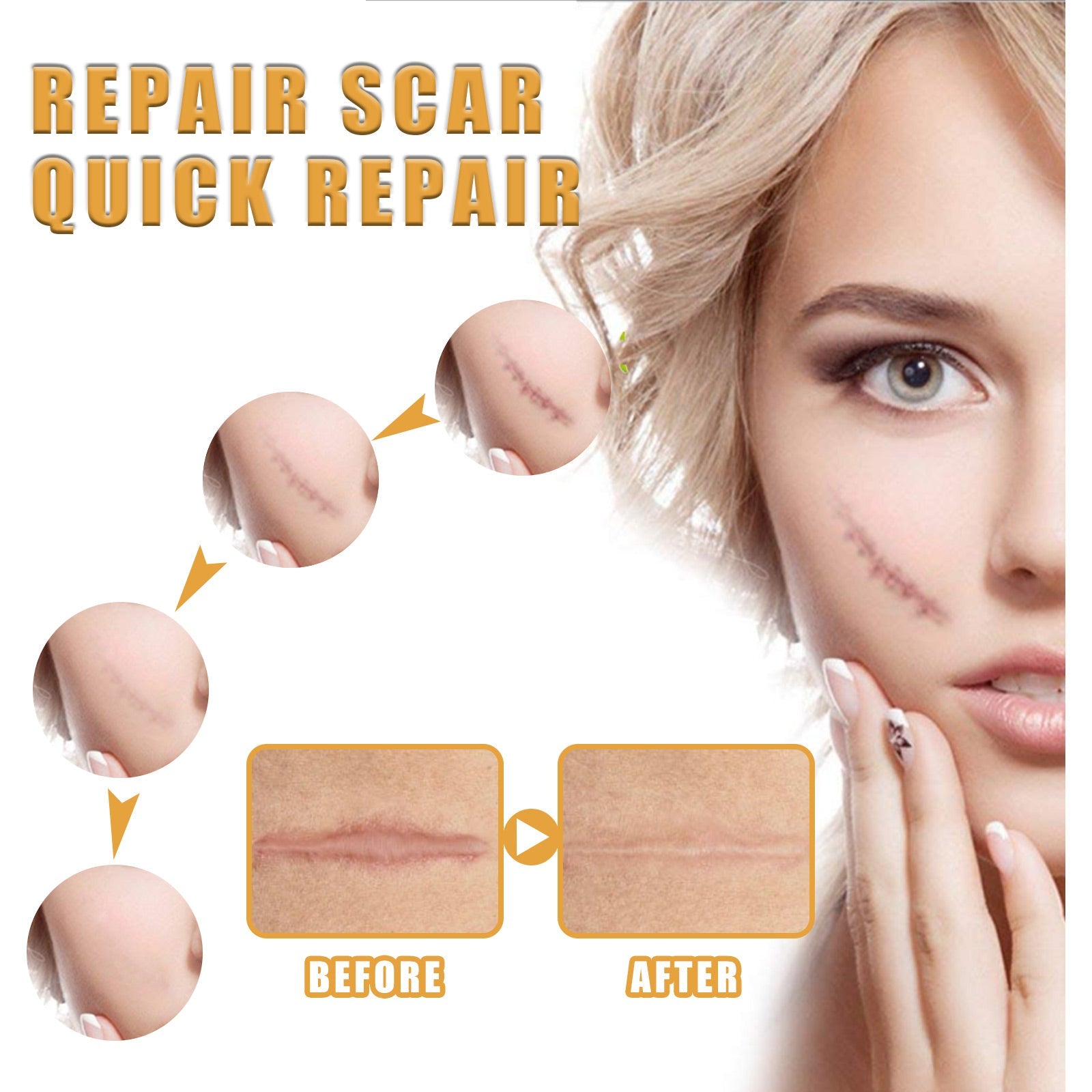 Desalting Skin Scar Cream, Skin Burn Scalding Surgical Scar Wound Repair Cream