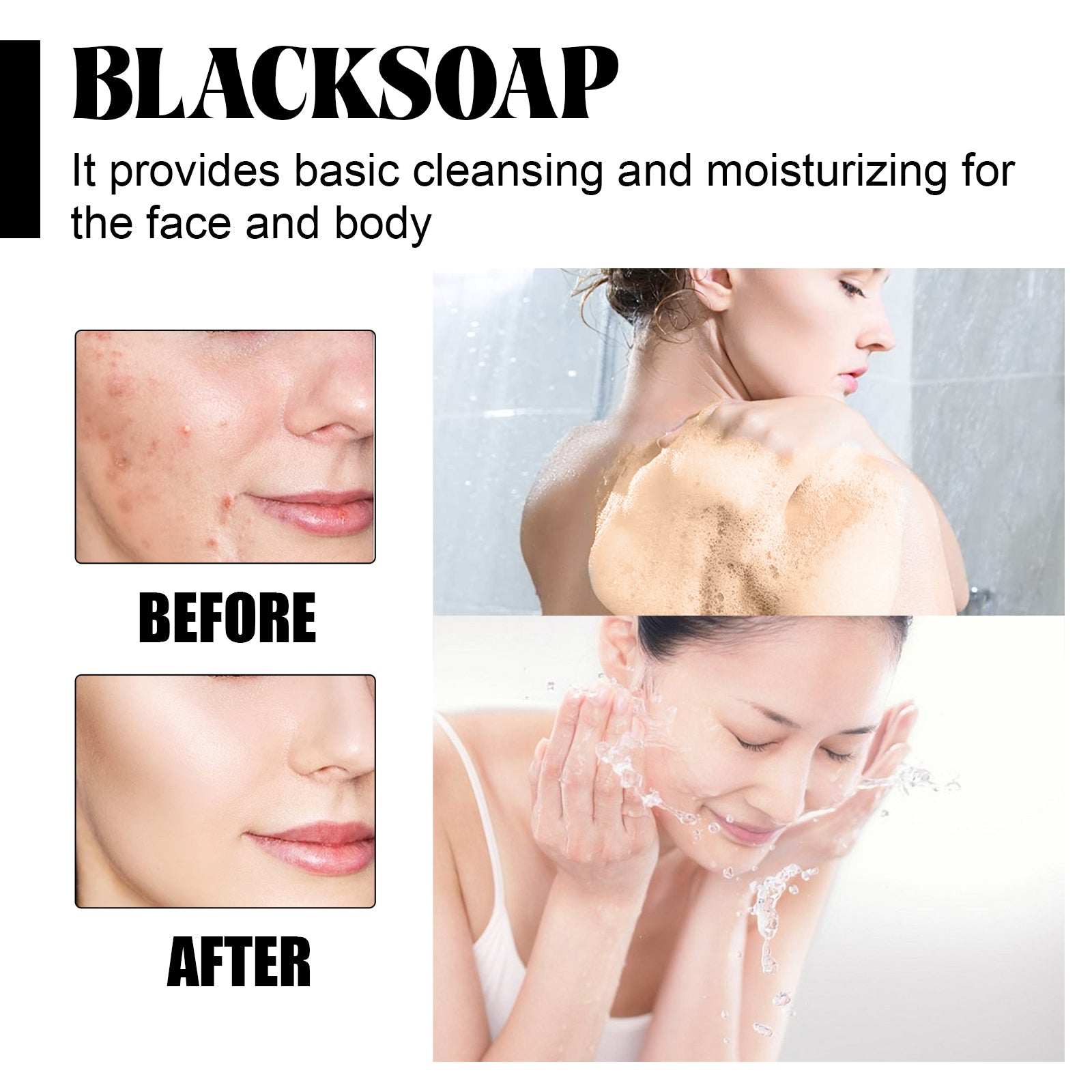 Shea Butter Black Soap, Repair Acne Pimple Acne Clear Pores Moisturize Smooth Skin Soap