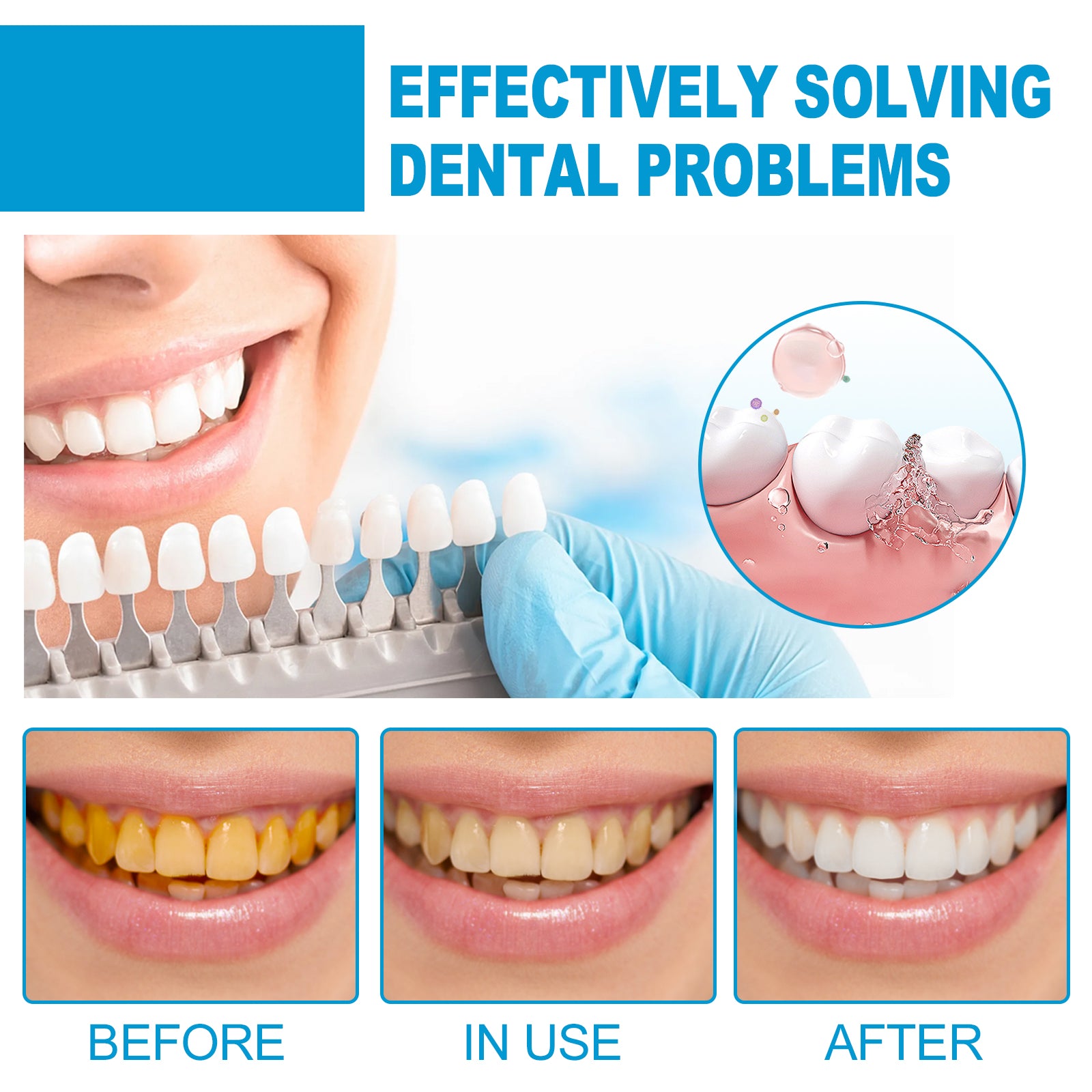 Mouth Mousse Toothpaste Teeth Clean Teeth Remove Tartar Stains Yellow Teeth Whitening Teeth Fresh Breath