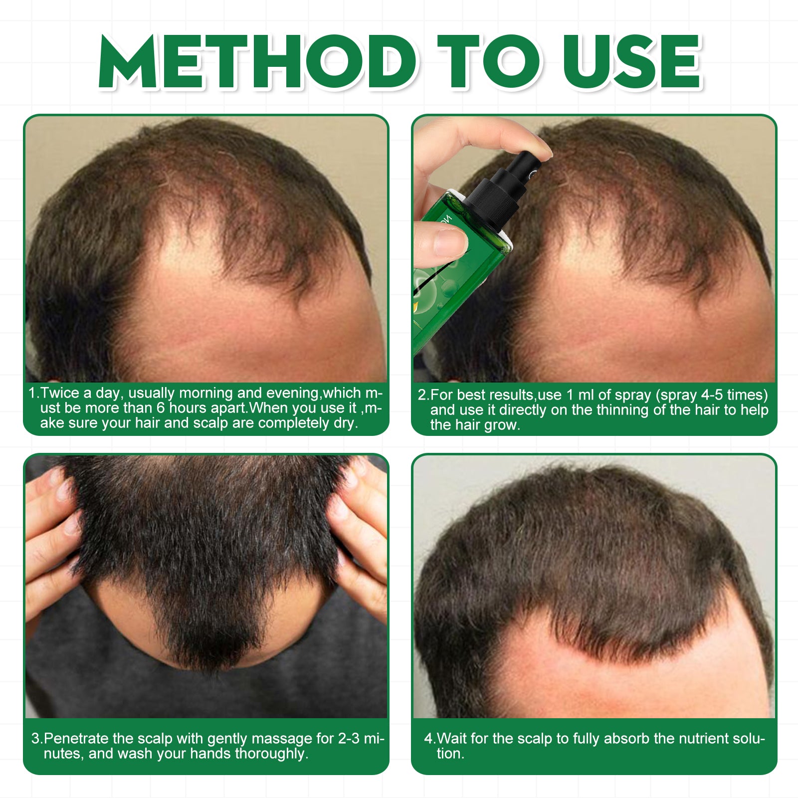 Men's Hair Serum For Hair Stabilization Nourishes And Nourishes Your Hairline