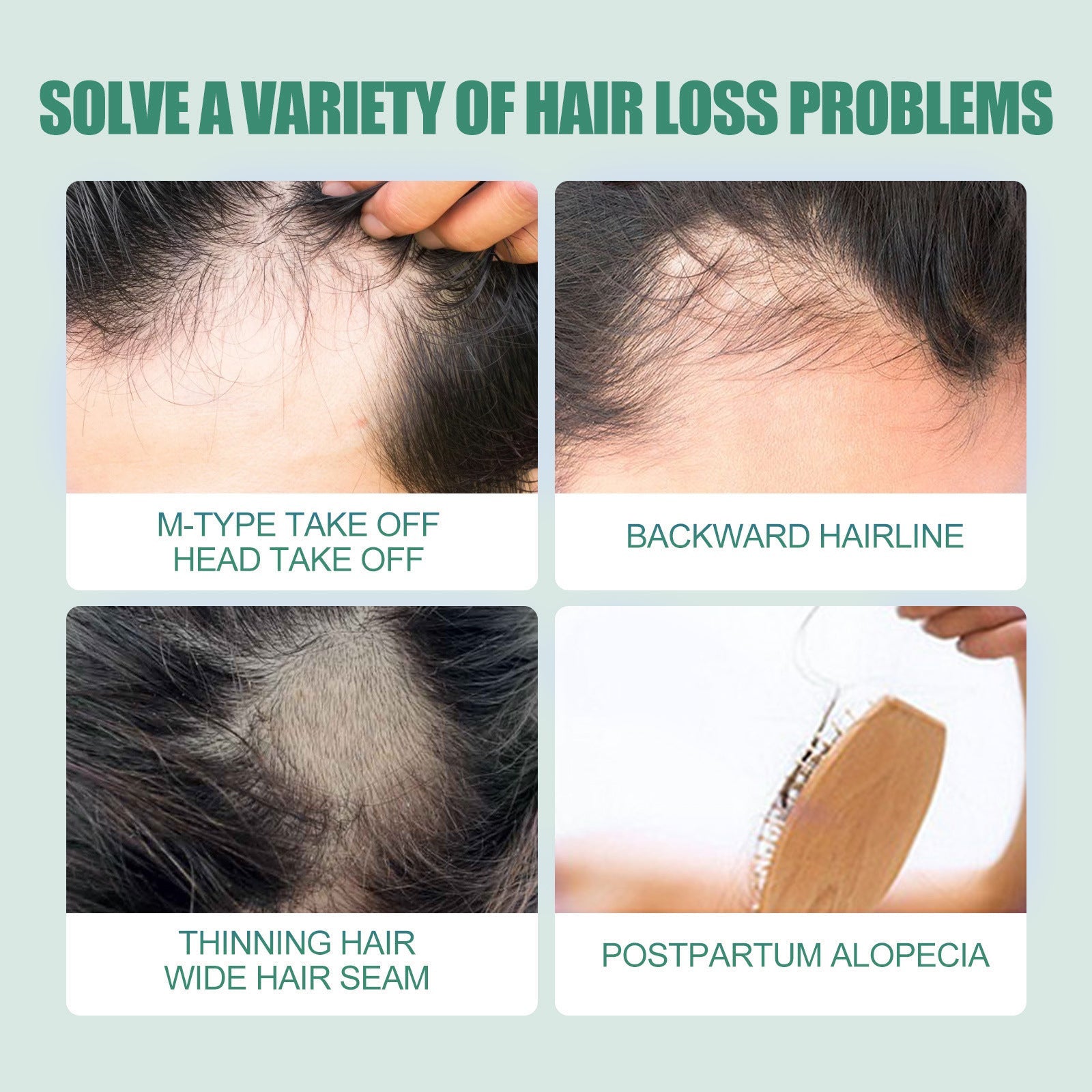 7 Days Essence Gently Moisturizes Hydrating Hairline Scalp Root Nourishing Hair Care Essential Oil