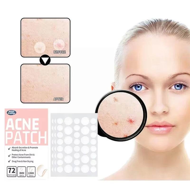Acne Spot Healing Patches – Invisible Waterproof Stickers for Pimple Removal, Marks, and Scar Care