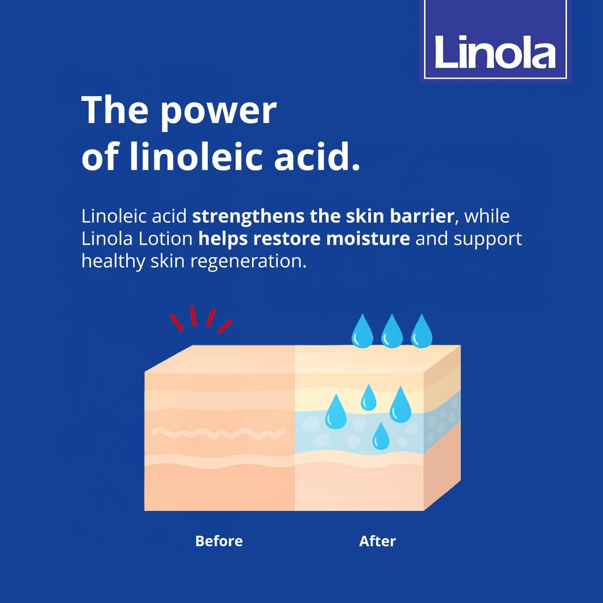 Linola Lotion - Daily Skin Care Solution | 200 ml