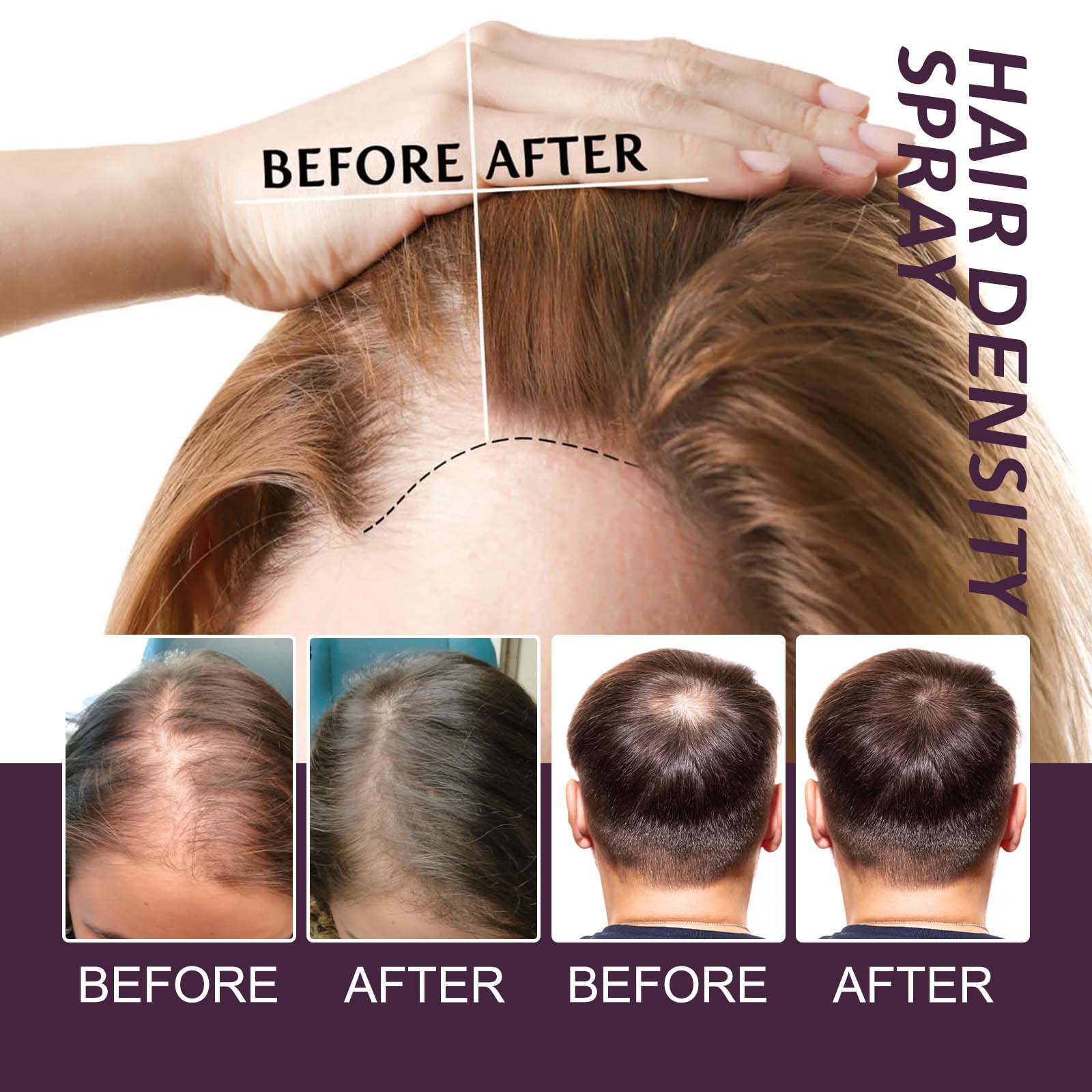 Volumizing And Dense Hair Spray, Repair Dry Hair, Strengthen Hair Nourishing And Volumizing Hair Treatment Spray