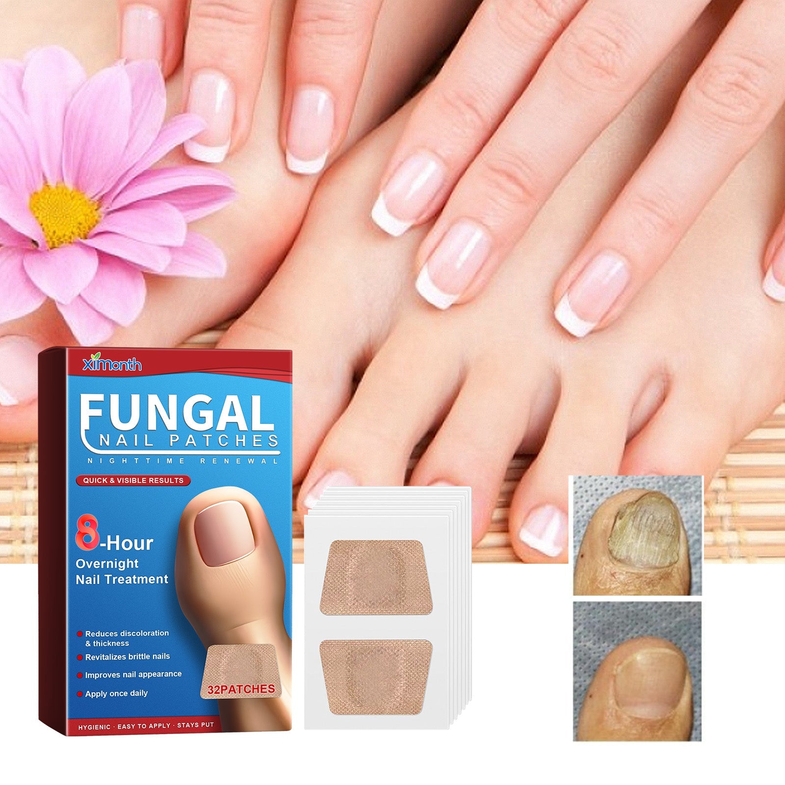 Nighttime Renewal Fungal Nail Patches, Repair And Thickening Gray Nail Insert Soft Nail Care Patch