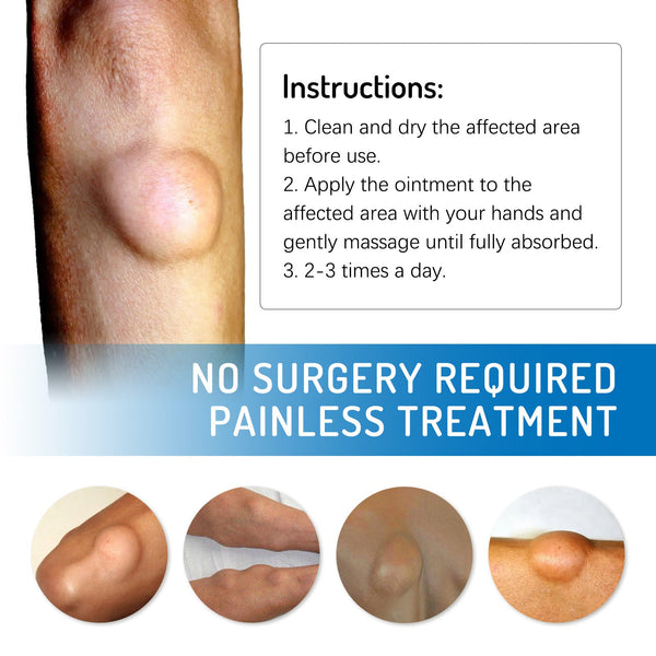 Body Care Cream Gentle Daily Nourishing Relief Of Physical Discomfort Leg Repair Cream