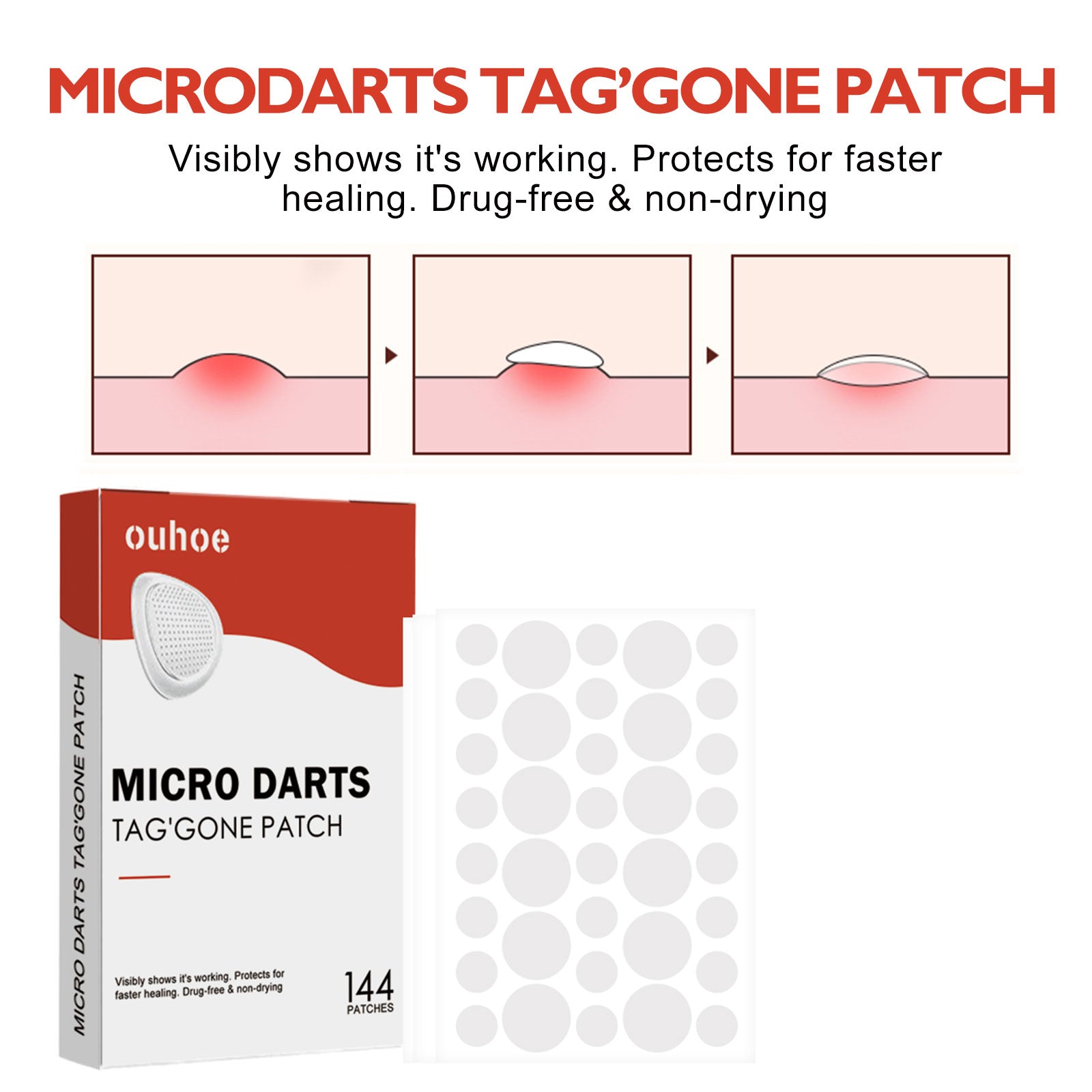 Acne Patch, Skin Clean Acne Pimple Moles Gram Wart Corns Spot Patch