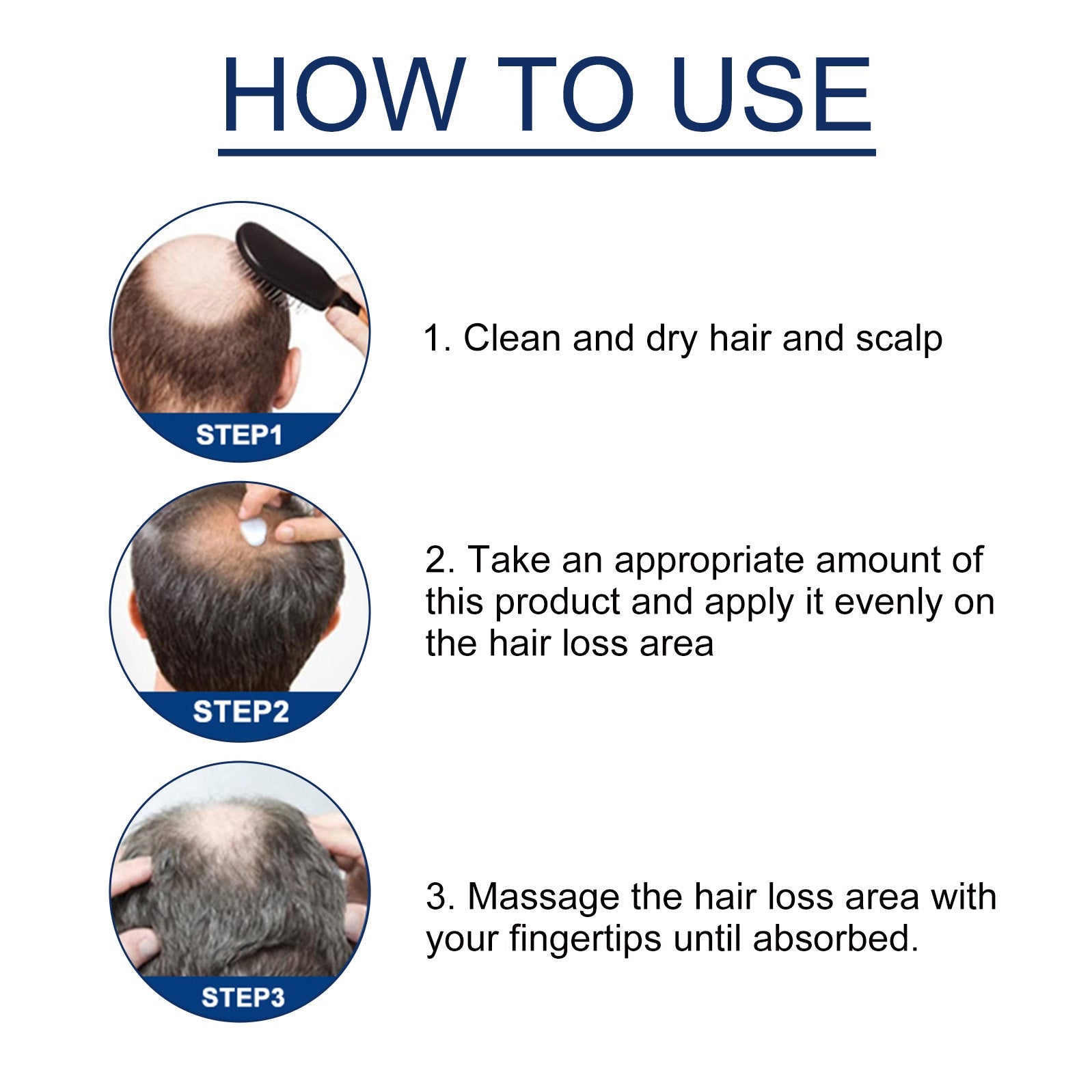 Alopecias Hair Growth Cream, Protect Hair Follicles Strong Moisturizing Thick Hairline Hair