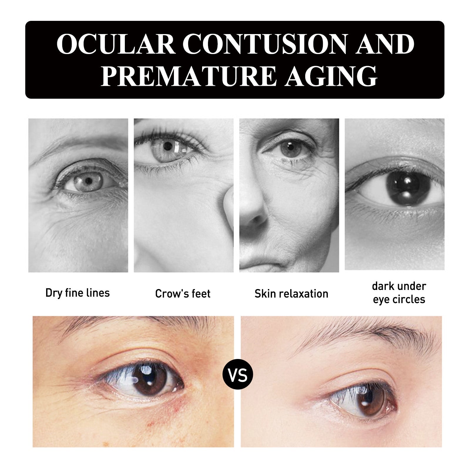 Strawberry Gel Patch Reduces Fine Lines Under Eyes, Bags Under Eyes, Dark Circles, Firming Eyes, Anti-Wrinkle Moisturizing Eye Patch