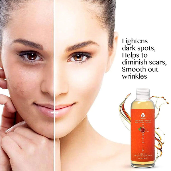 100% Pure & Natural Cold Pressed Premium Rosehip Seed Oil 6 Oz - Gifts for You 'n Me